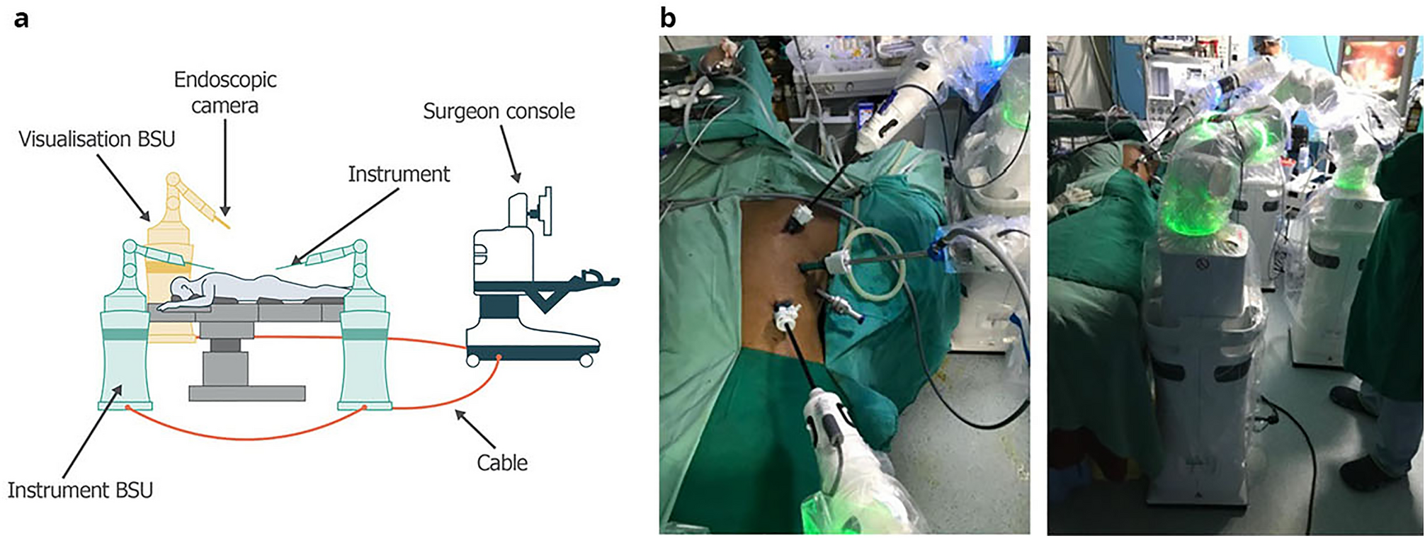 Feasibility of transthoracic esophagectomy with a next-generation surgical  robot | Scientific Reports