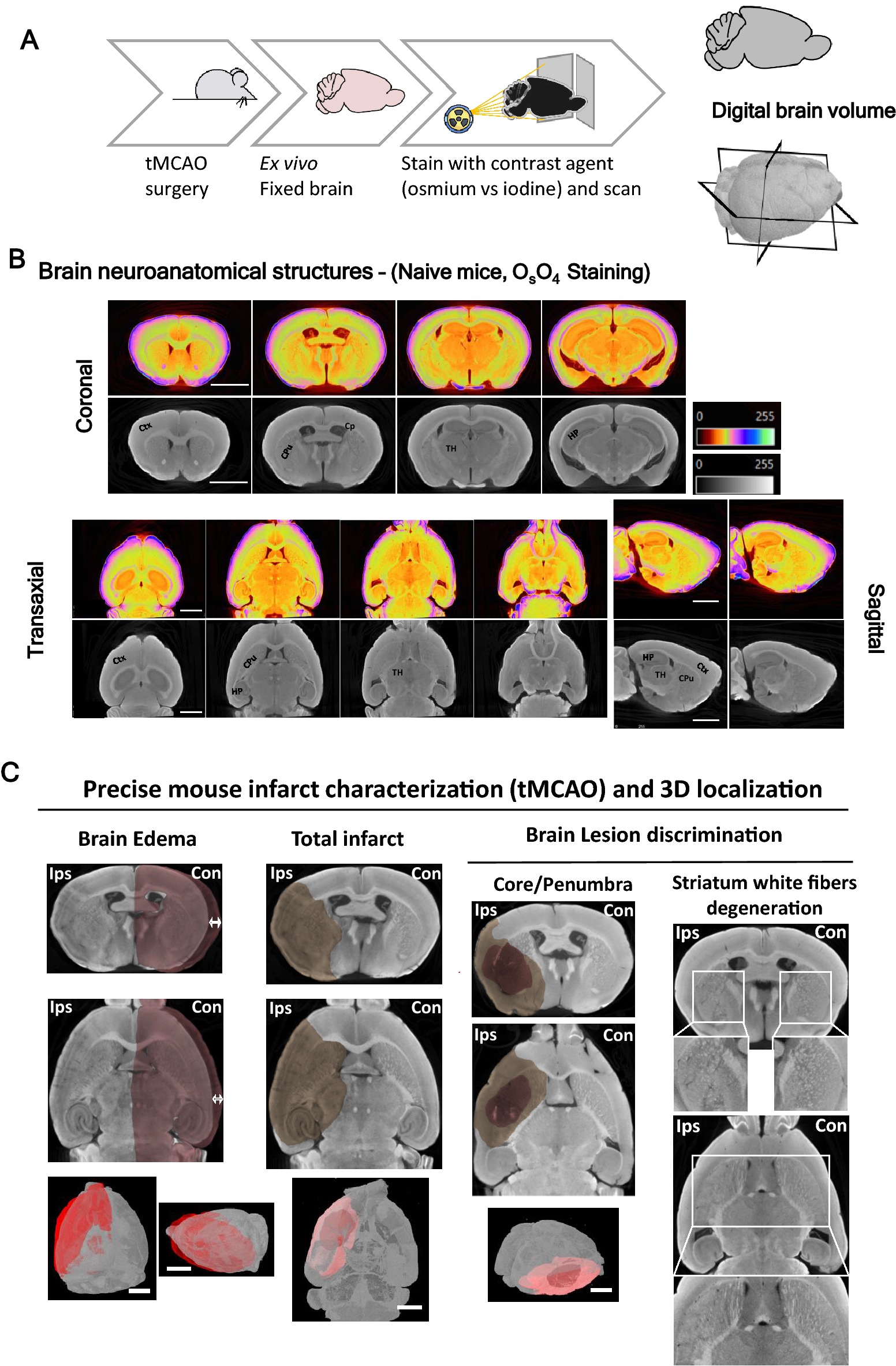 High-resolution micro-CT for 3D infarct characterization and segmentation  in mice stroke models