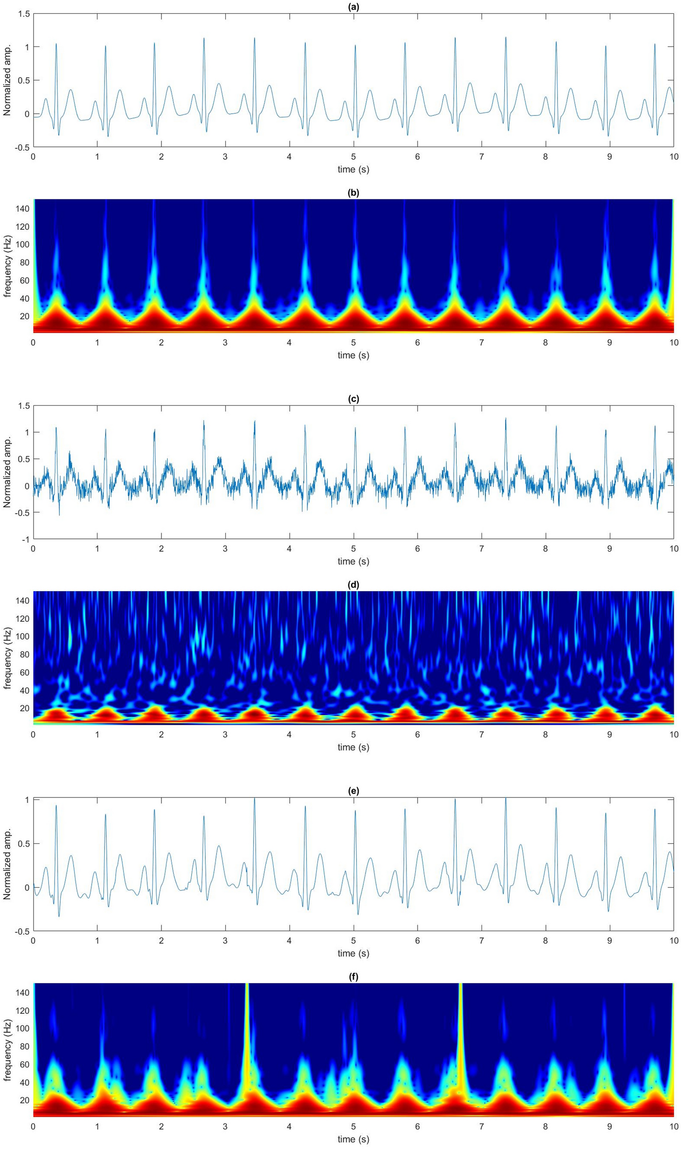 A two-step pre-processing tool to remove Gaussian and ectopic noise for  heart rate variability analysis | Scientific Reports