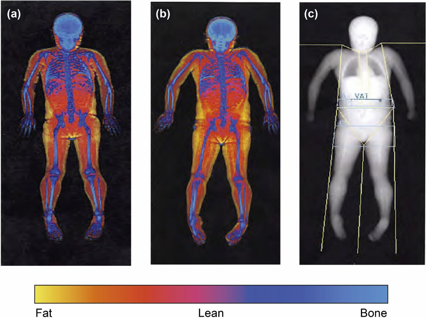 Advanced Body Composition Testing - Summit Health
