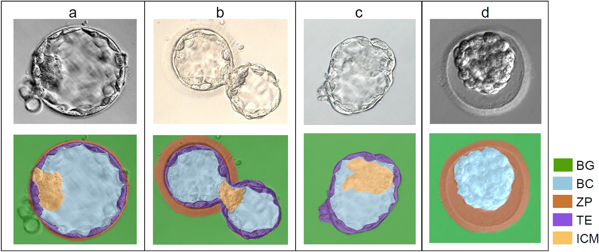 Automated identification of blastocyst regions at different development  stages | Scientific Reports