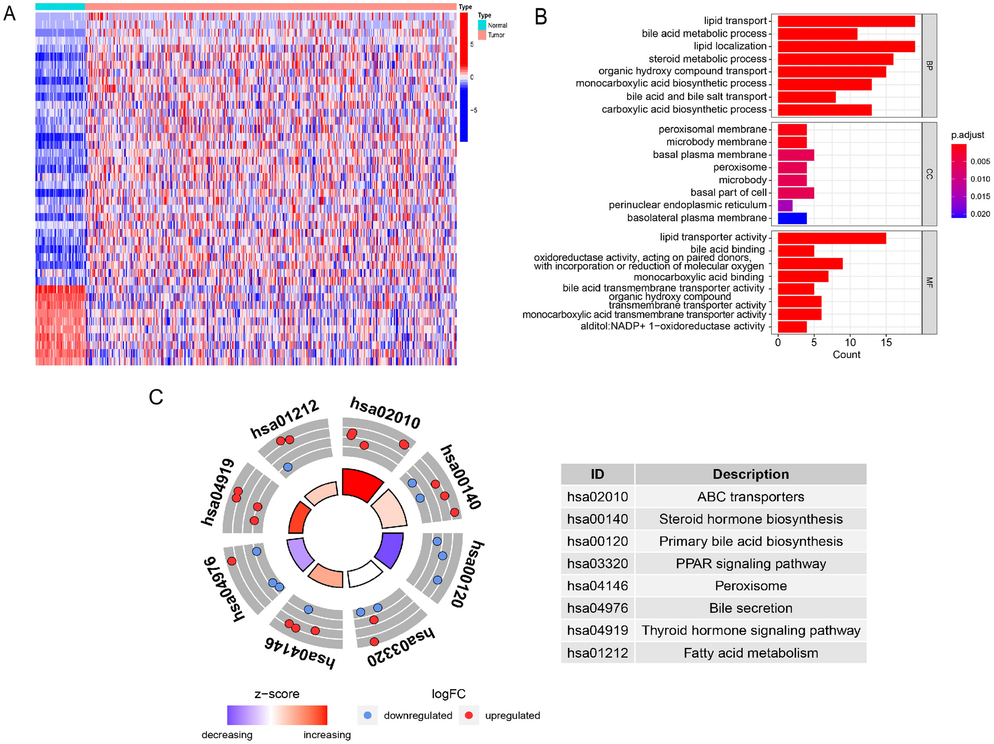 Hepatocellular carcinoma as a complication of Niemann‐Pick disease