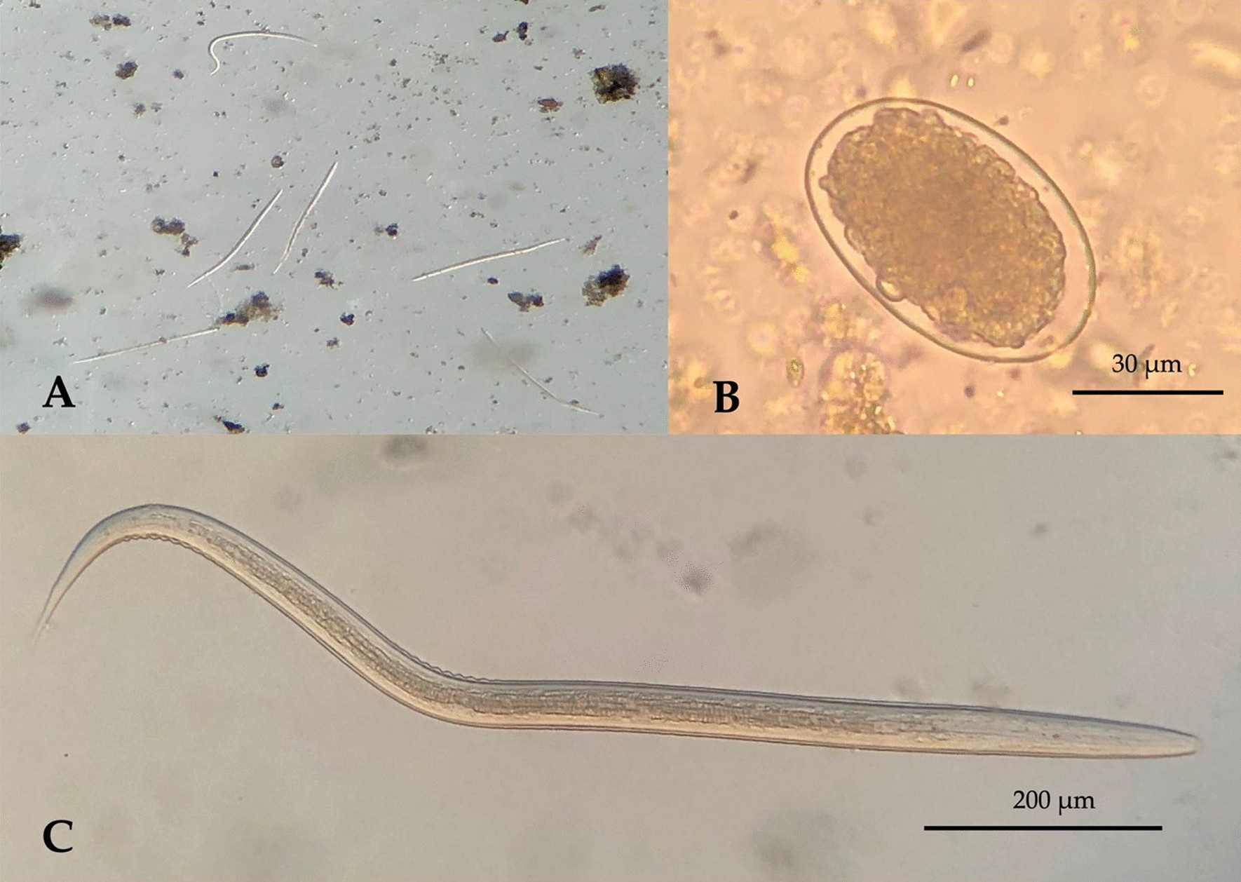 Molecular evidence of hookworms in public environment of Bangladesh |  Scientific Reports