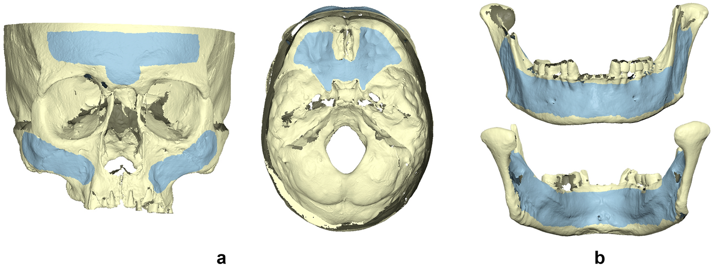 Anterior Skull  ditki medical and biological sciences