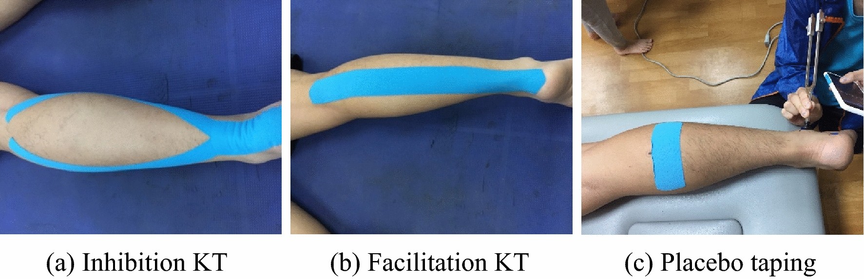 Effects of the direction of Kinesio taping on sensation and postural  control before and after muscle fatigue in healthy athletes | Scientific  Reports