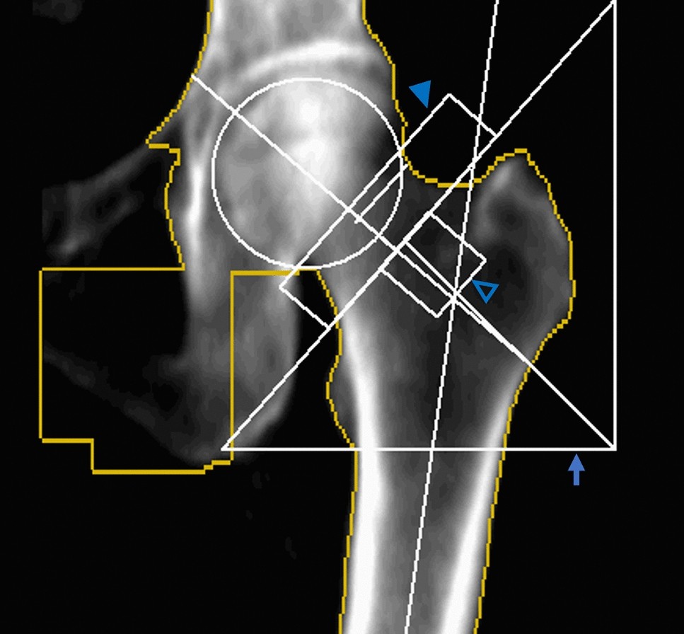 Bone Density Evaluation (DEXA) - Patient Services - Assured Imaging