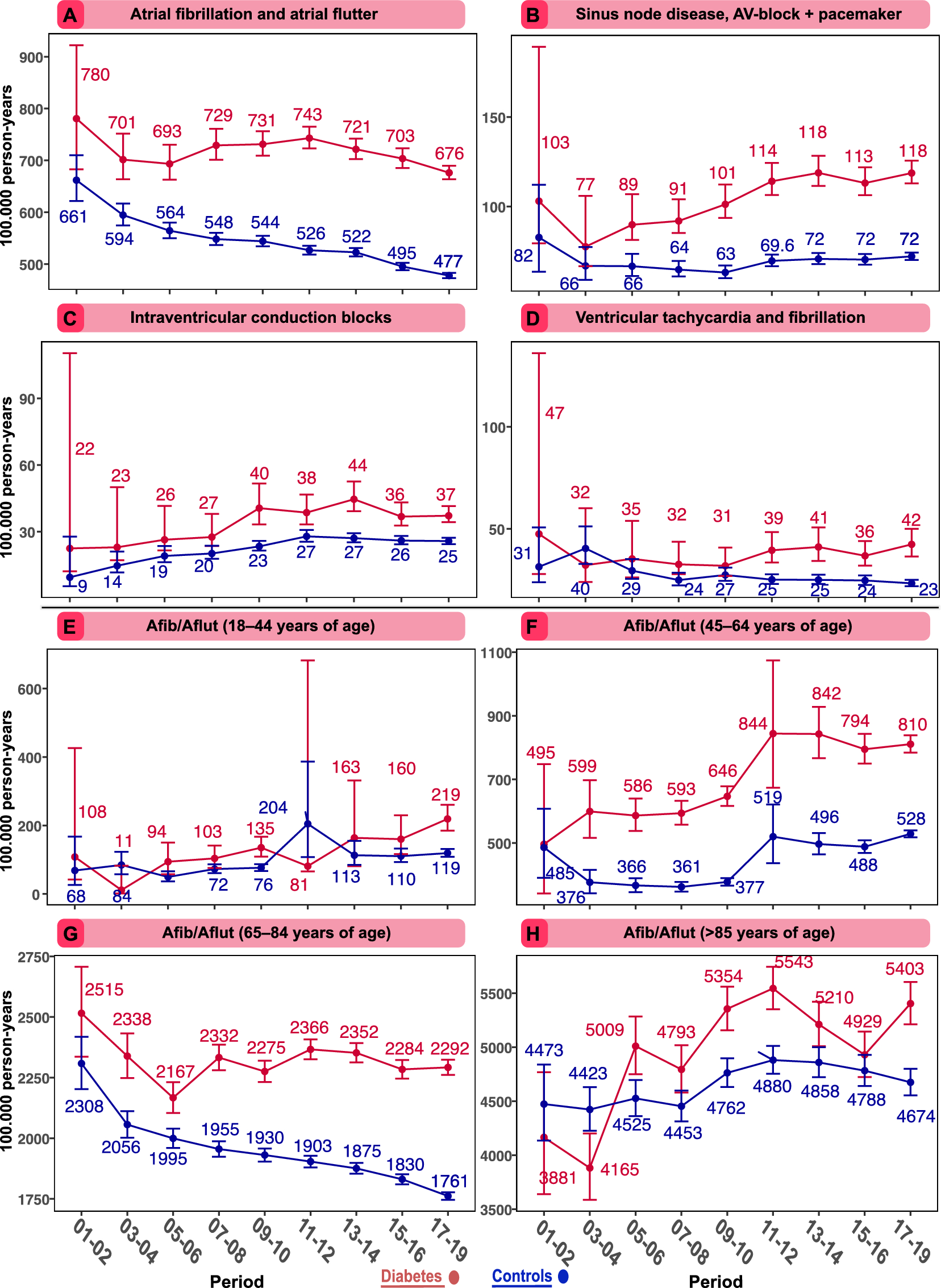 Incidence and predictors of developing high-degree AV block in patients