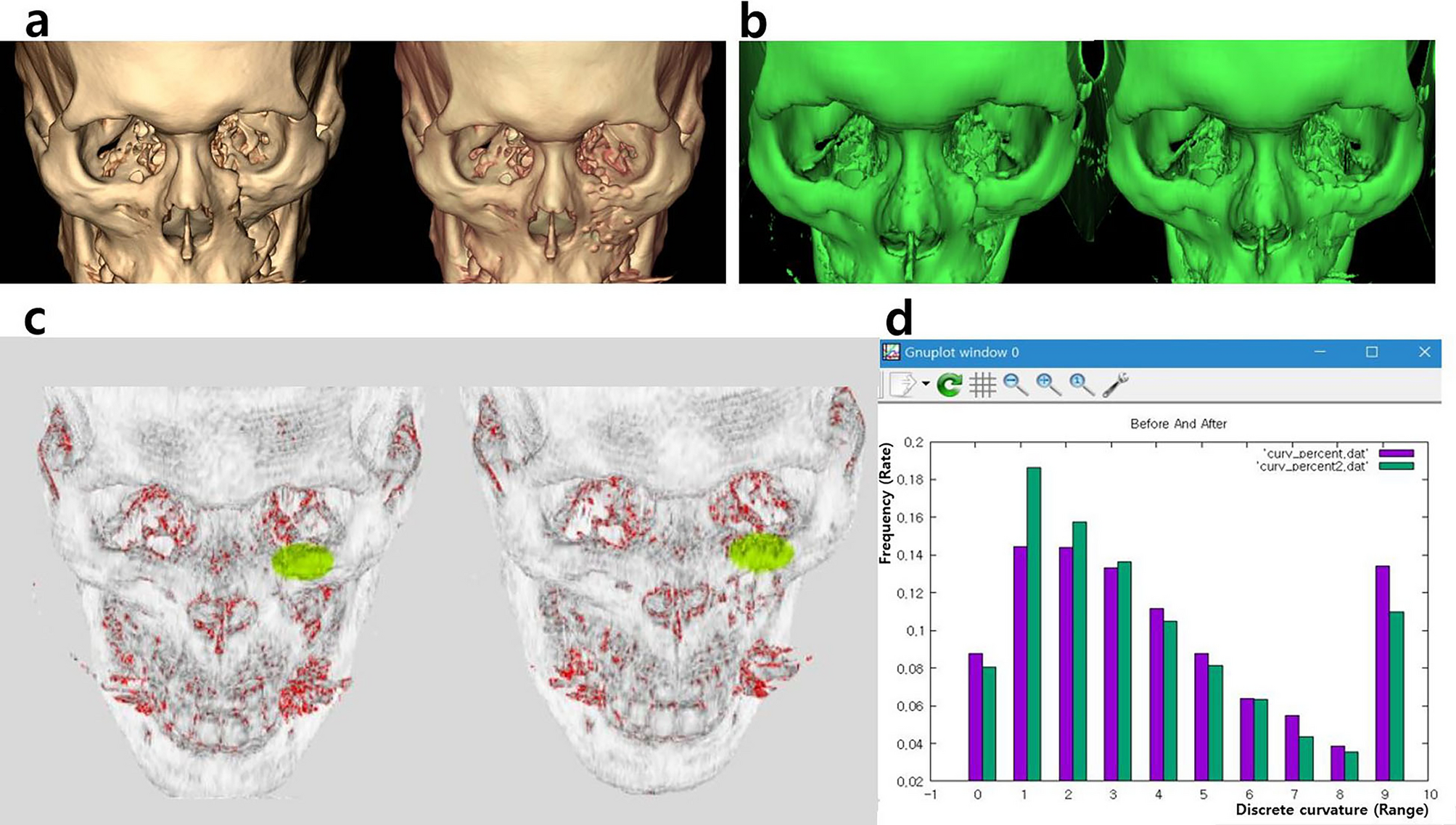 Morphometric evaluation of the face contours/volumes. (a) Face