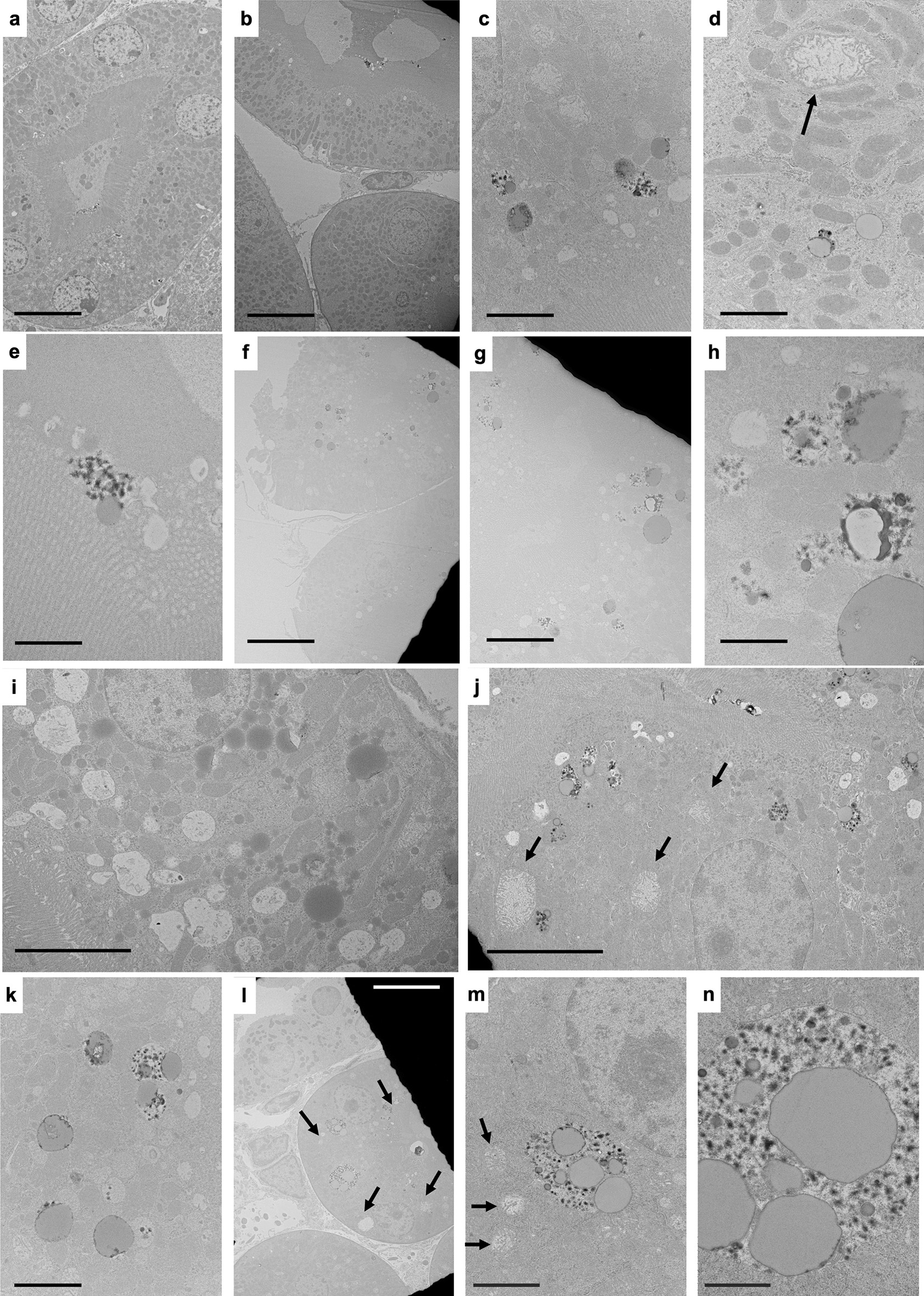 Micrographs of low, medium and high carbon steel a, e, i Untreated, b