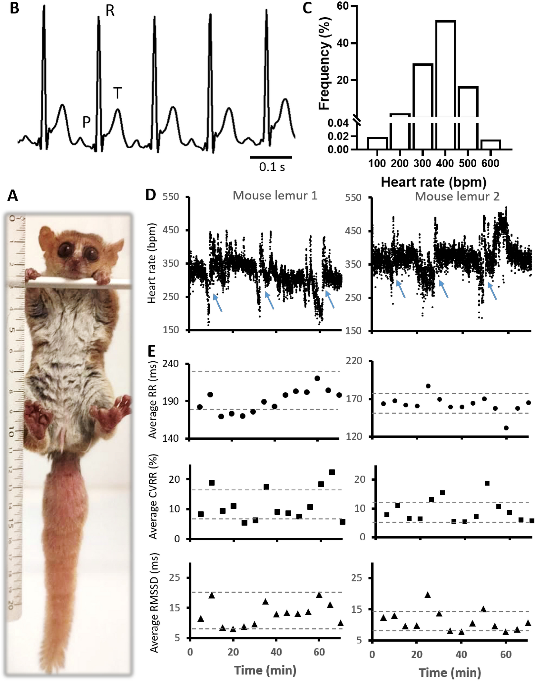 Characterization of sinoatrial automaticity in Microcebus murinus to study the effect of aging on cardiac activity and the correlation with longevity Scientific Reports