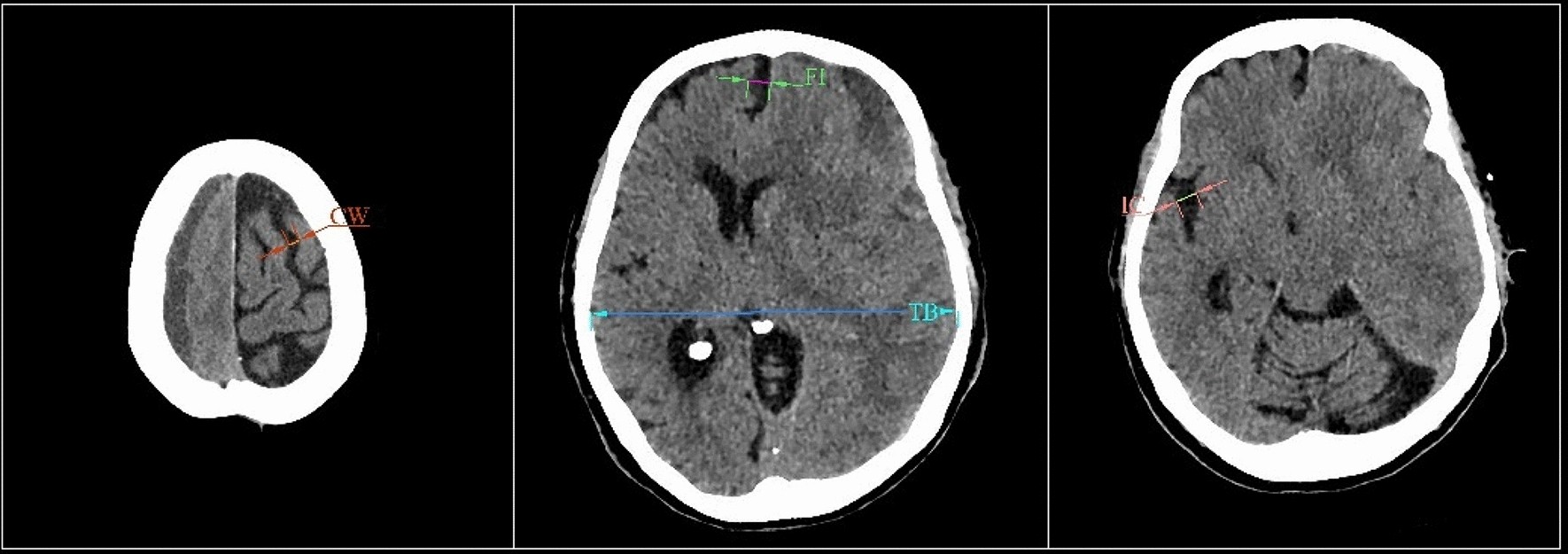 Bid to stop brain test on coma relative