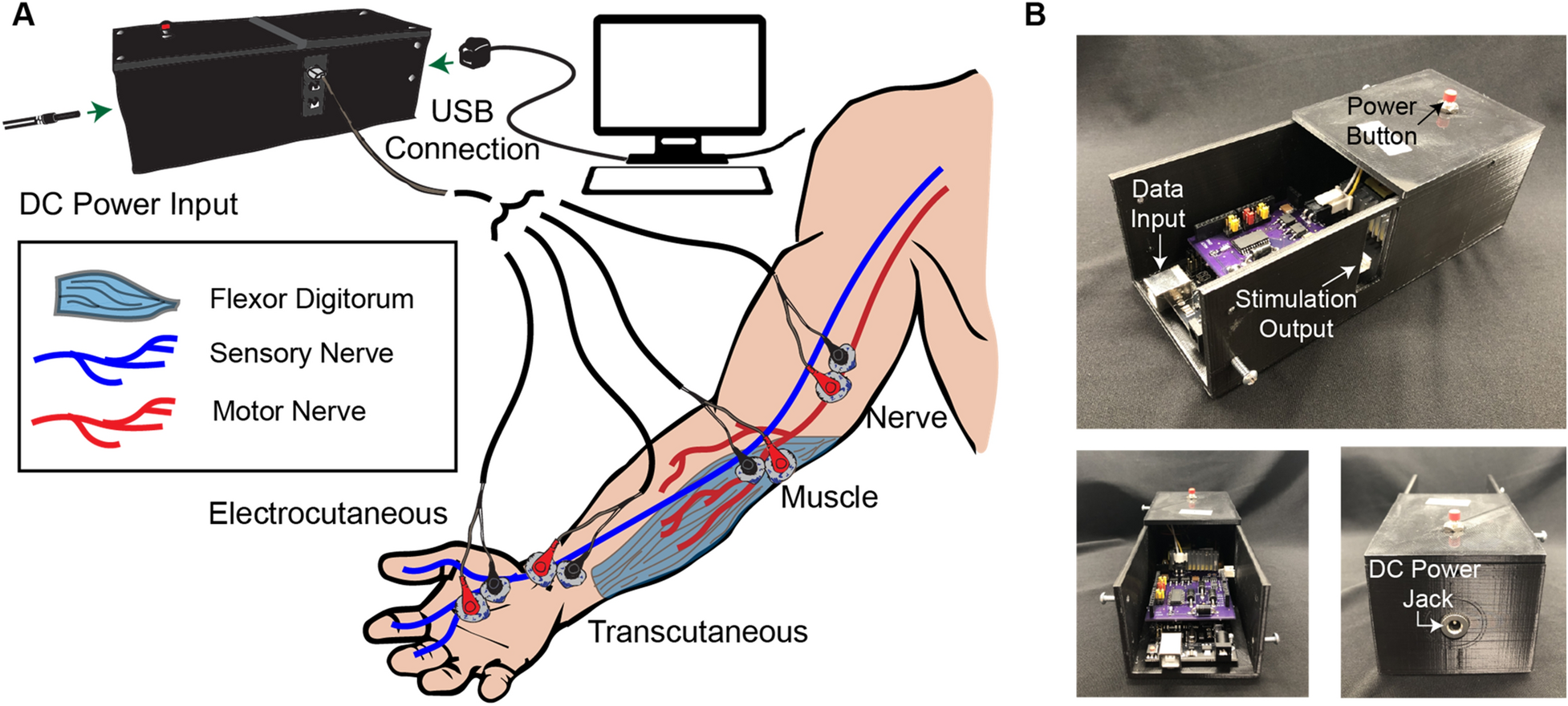 Electrical muscle stimulation: What it is, uses, and more