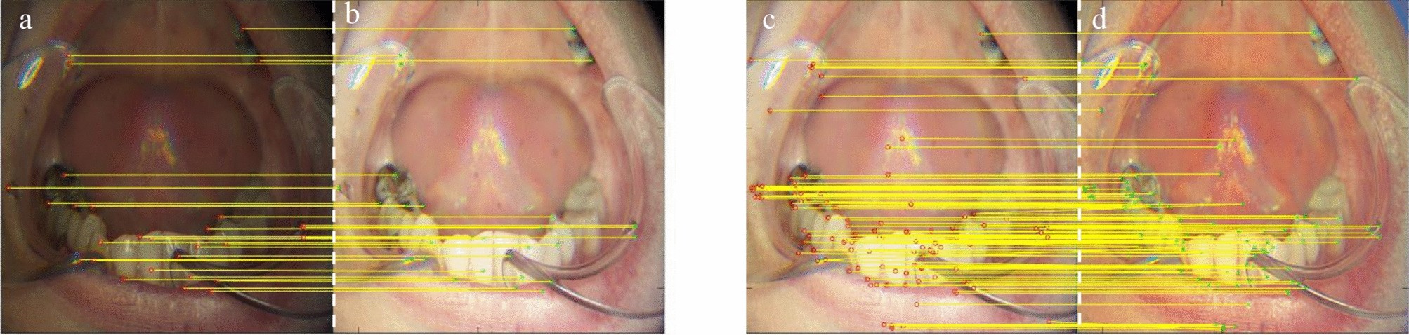 Figure 15