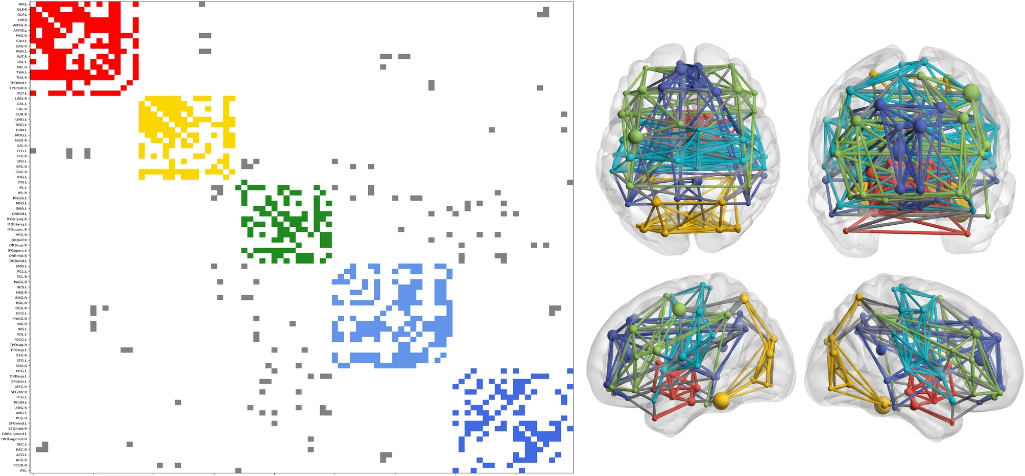 Graph partitioning of the communities defined by using QA for the AAL atlas. Left: Reordered connectivity matrix according to module assignment. Right: Axial, coronal, and 2 hemispheres sagittal views of brain connectivity (plotted using the BrainNet Viewer Toolbox36). In both cases, connections and nodes belonging to the same community are plotted using the same color code while grey edges correspond to connections between different modules. The size of the nodes is given by the degree.