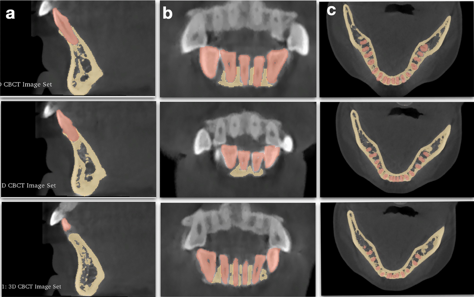 Essential requirements of a non-occlusal mandibu- lar reference