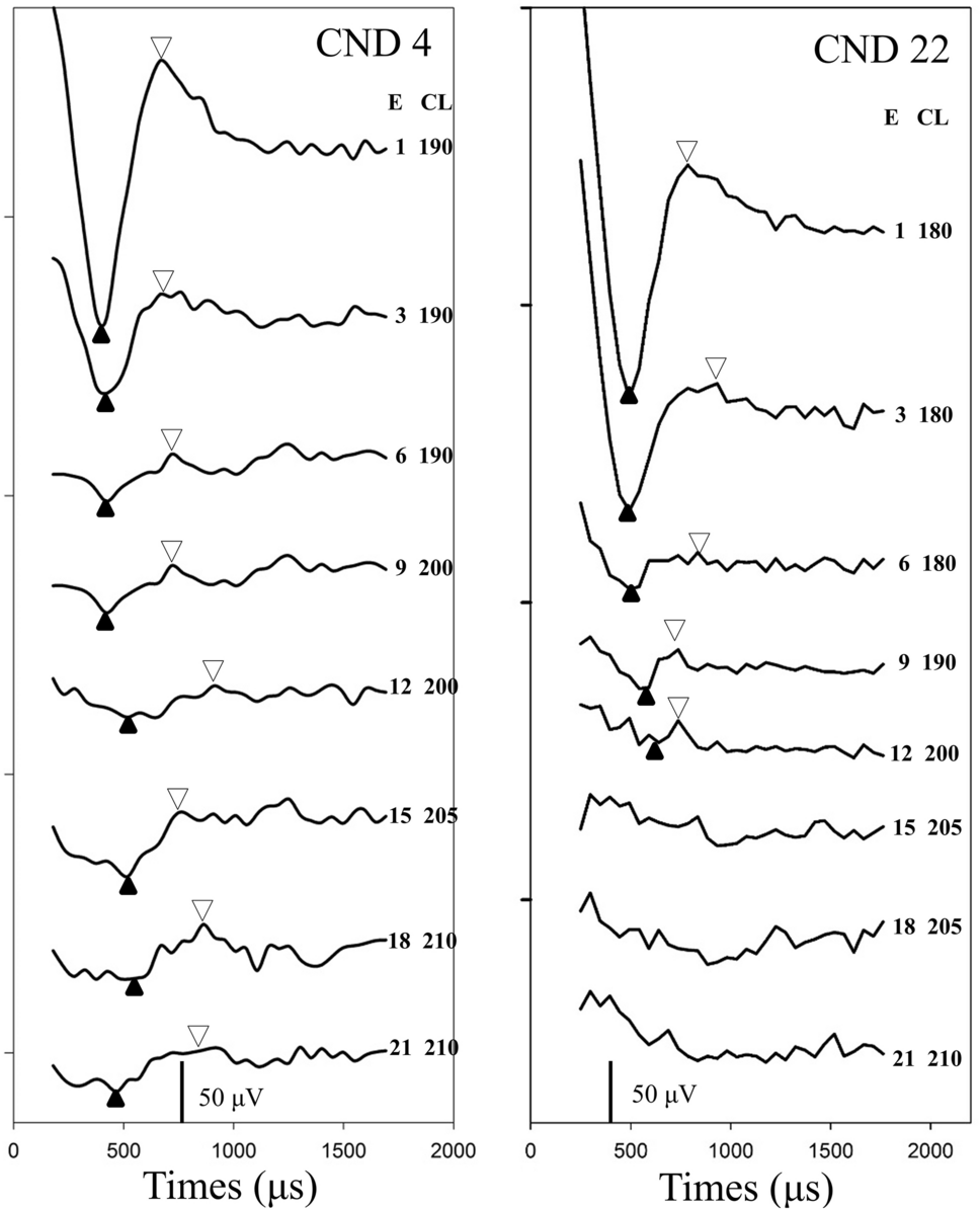 Examination and Comparison of Electrically Evoked Compound Action