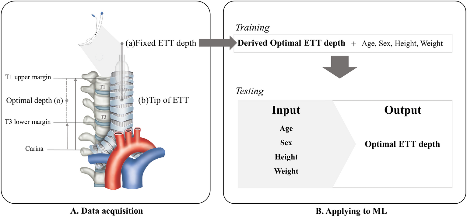 Predicting the risk of inappropriate depth of endotracheal 