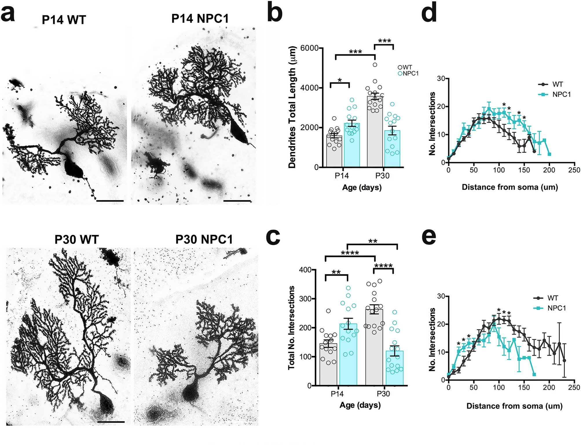 Niemann-Pick disease type C as a neurovisceral disease. Schematic