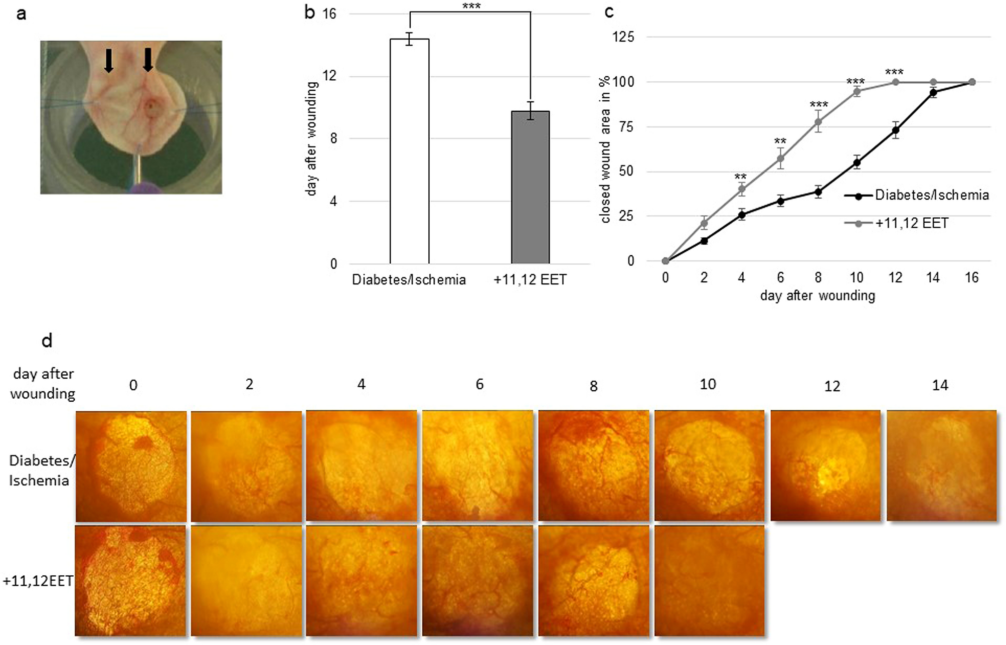 Various effects of 11,12 EET rescue wound healing in a combined model of  diabetes and ischemia | Scientific Reports