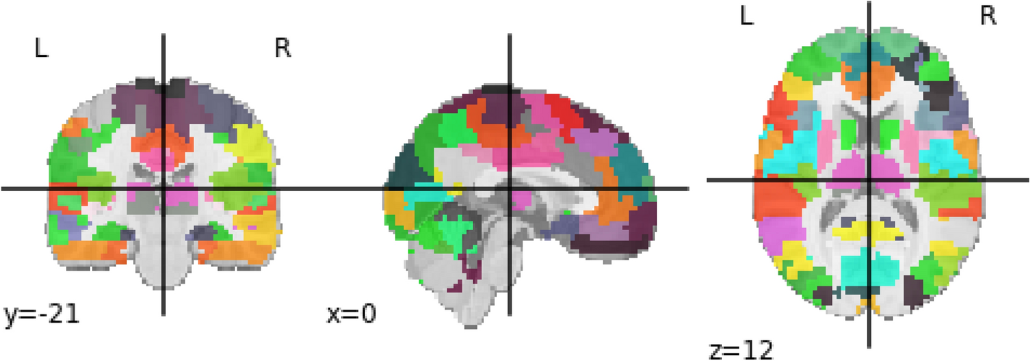 Diagnosis of autism spectrum disorder based on functional brain networks and machine learning