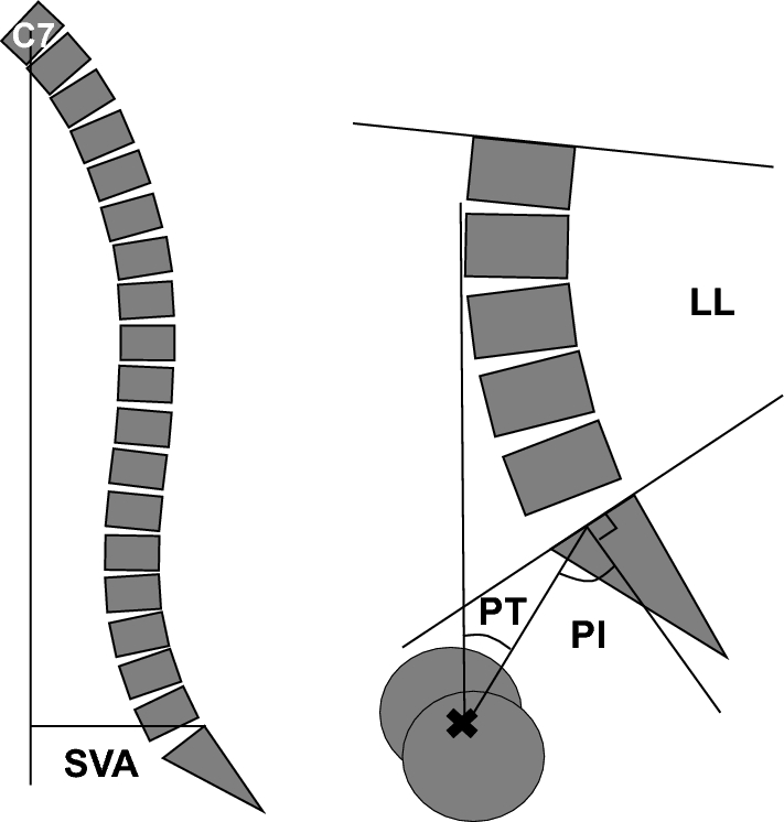 Association between trunk muscle mass and log of visual analog scale