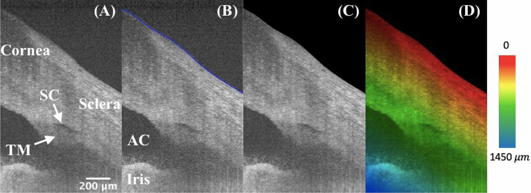 Iridocorneal angle imaging of a human donor eye by spectral-domain optical  coherence tomography | Scientific Reports