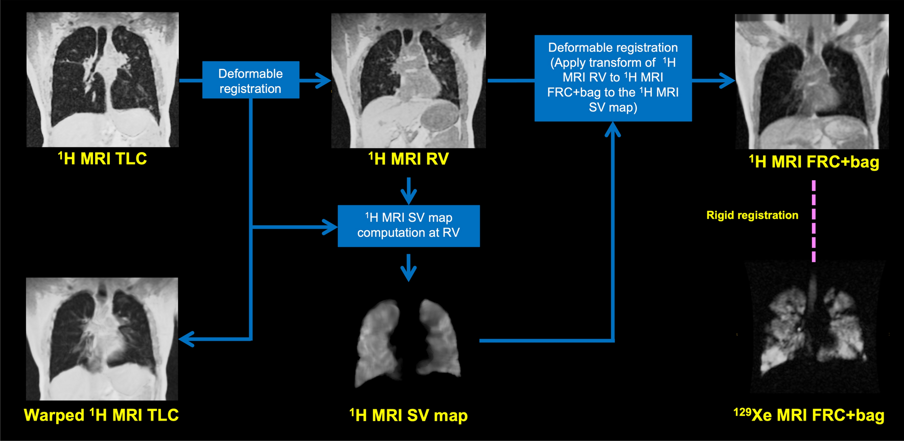 PhysVENeT: a physiologically-informed deep learning-based 