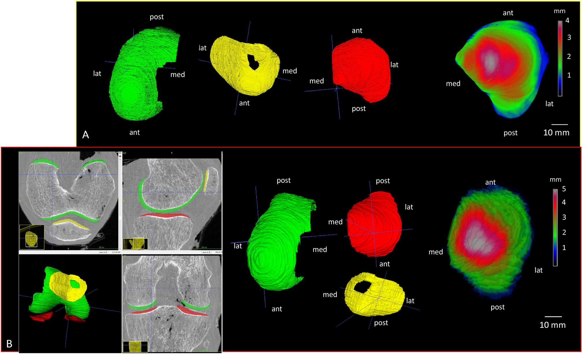 Contrast‐enhanced micro‐computed tomography of compartment and