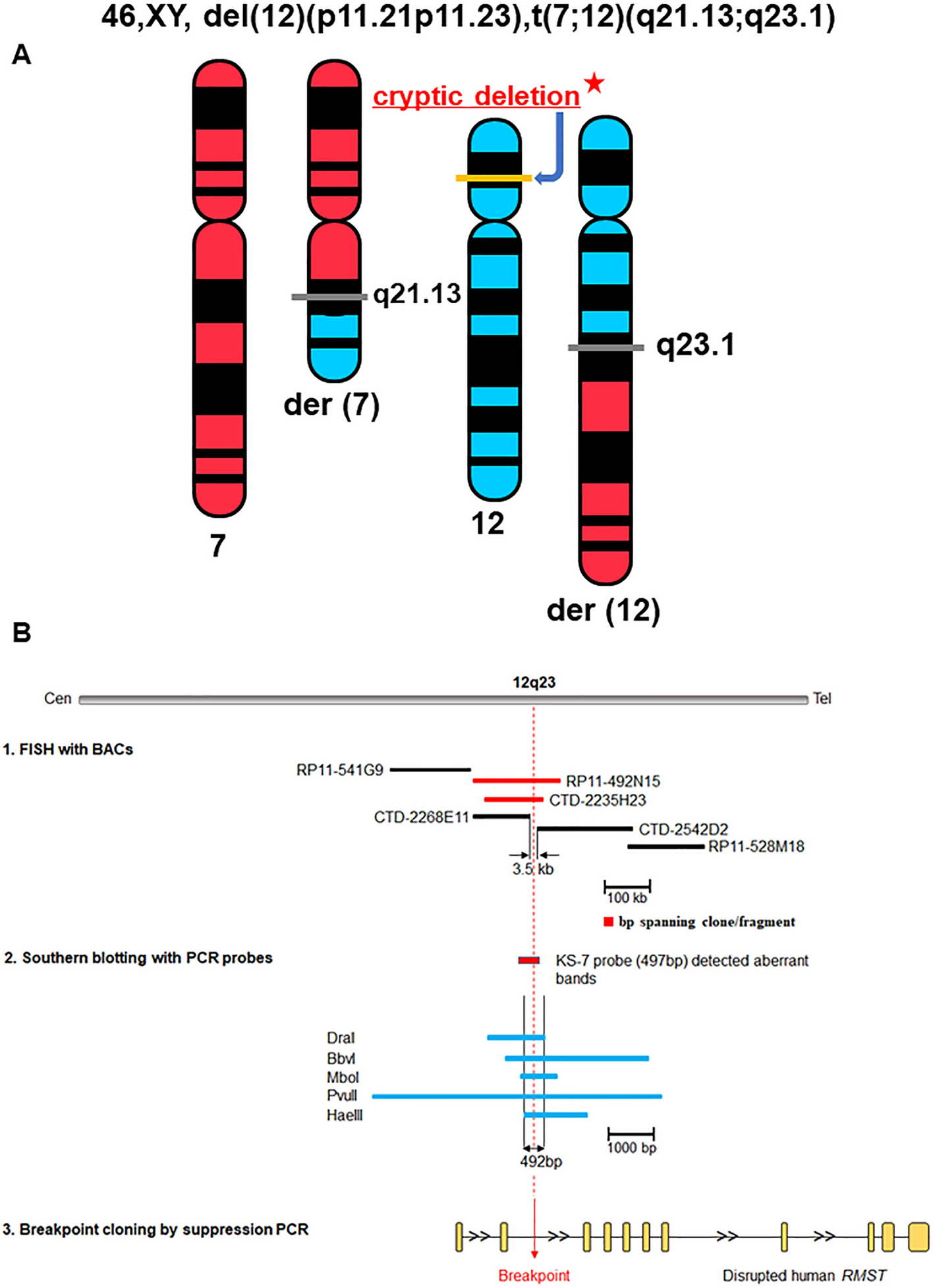 Ring chromosome 4 : 46, XY, r (4) (p16q351 in a boy To our knowledge 18  cases of fing chromusome 4 ha...e