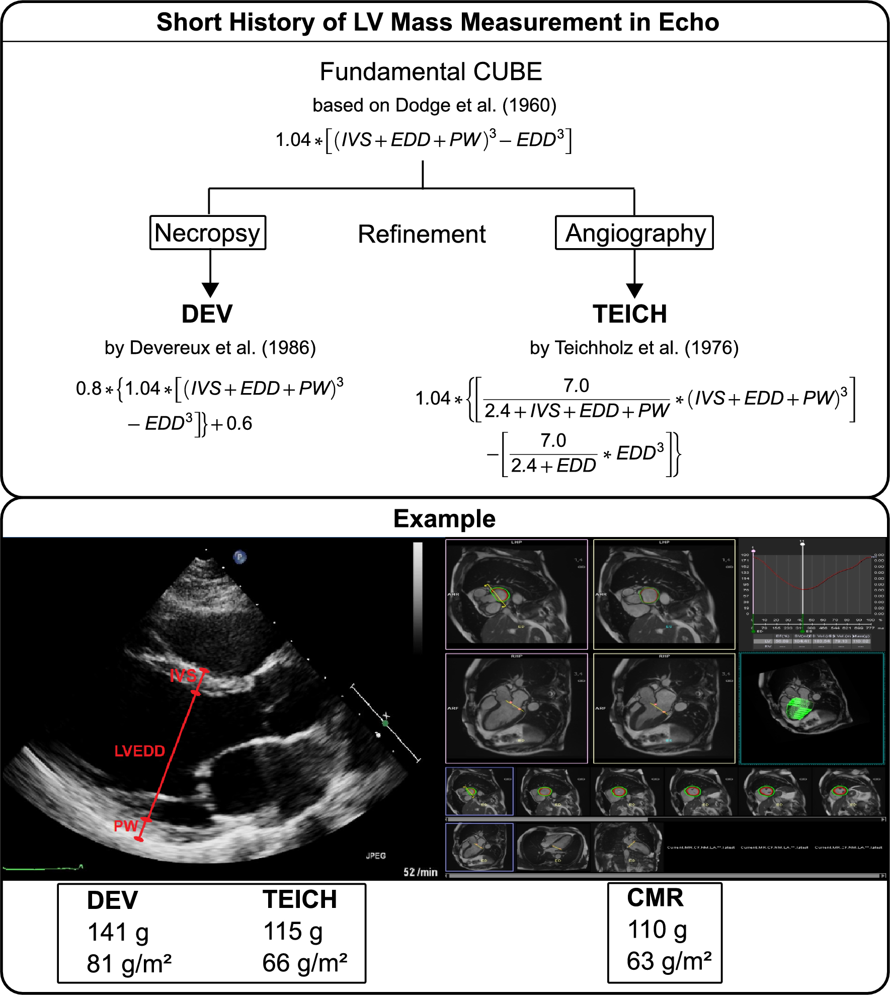 Echocardiography online normal values tables