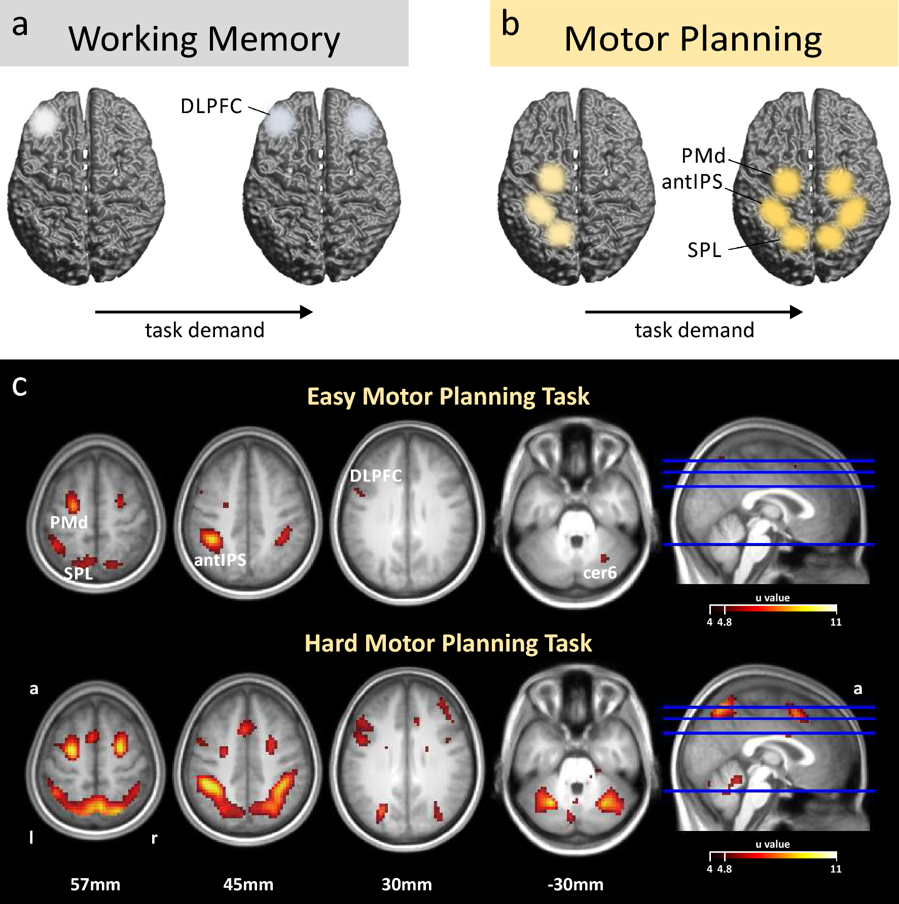 Cross-hemispheric recruitment during action planning with 