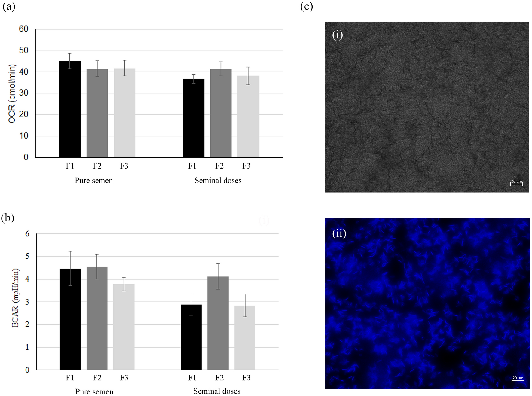 Impact of inclusion of post-spermatic ejaculate fraction in boar seminal  doses on sperm metabolism, quality, and interaction with uterine fluid |  Scientific Reports