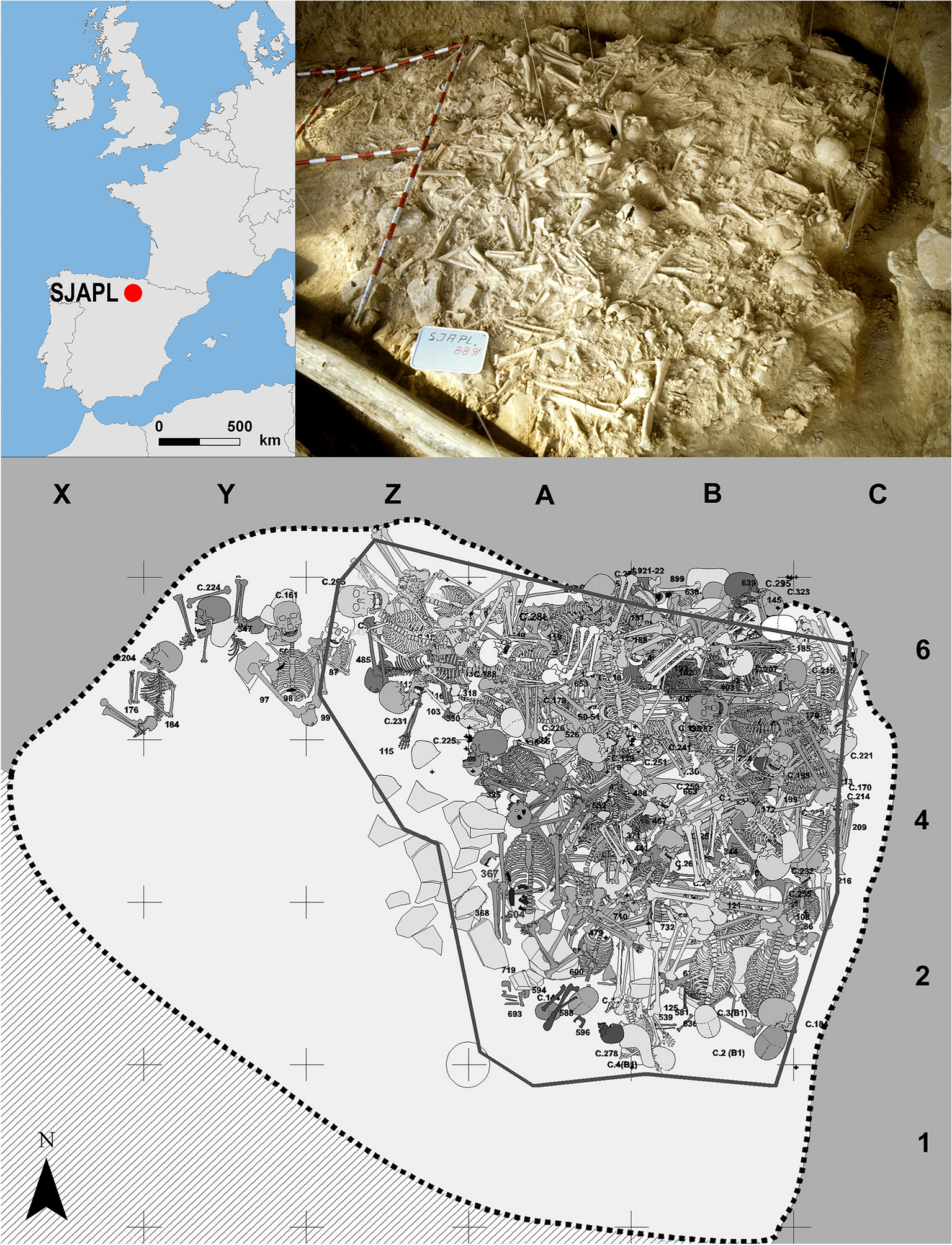 Spanish Conquistador Human Skull with Broad Ax Trauma - Bone