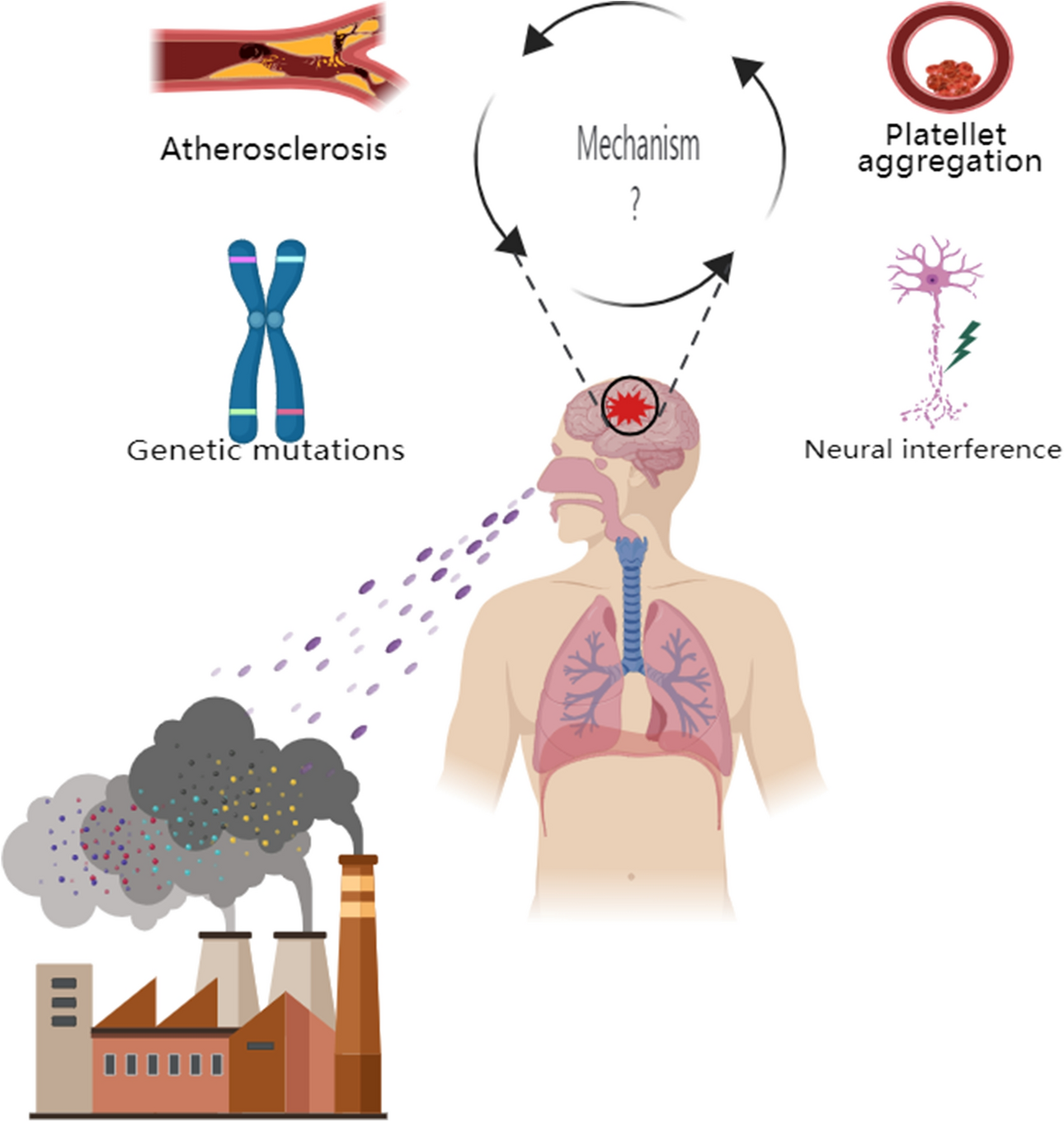 Research progress of different components of PM2.5 and ischemic 