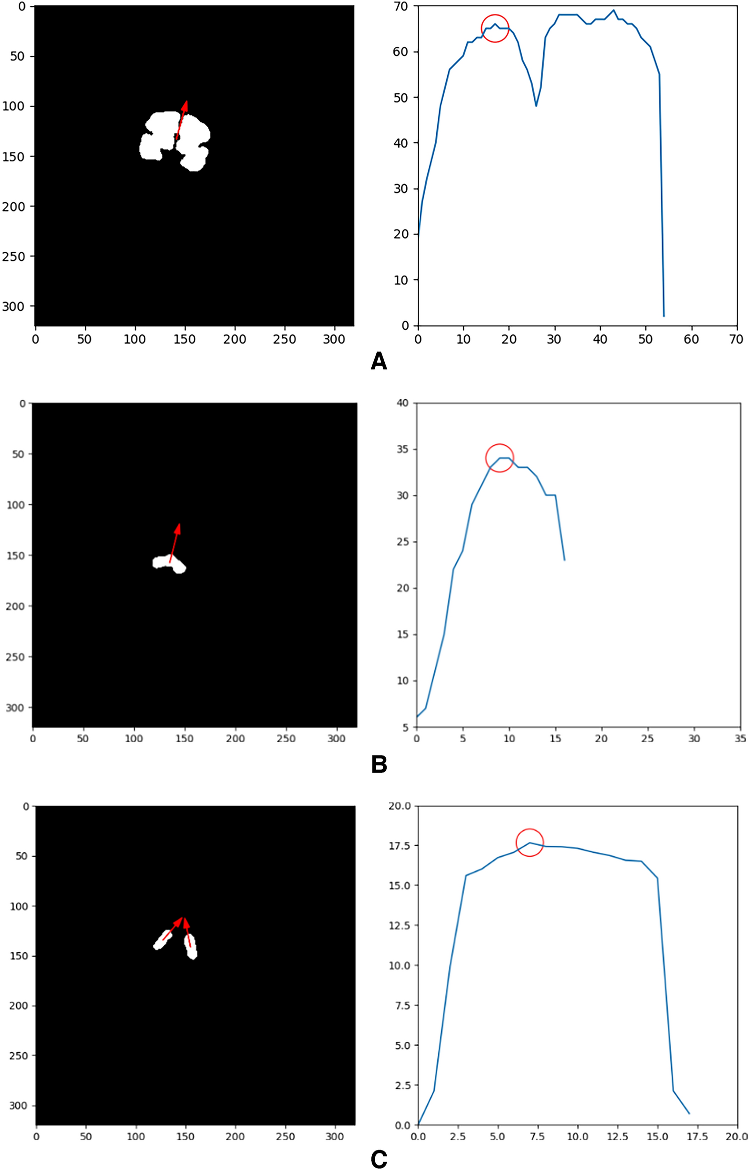 Use of MRI in the diagnosis of fetal brain abnormalities in utero  (MERIDIAN): a multicentre, prospective cohort study - The Lancet