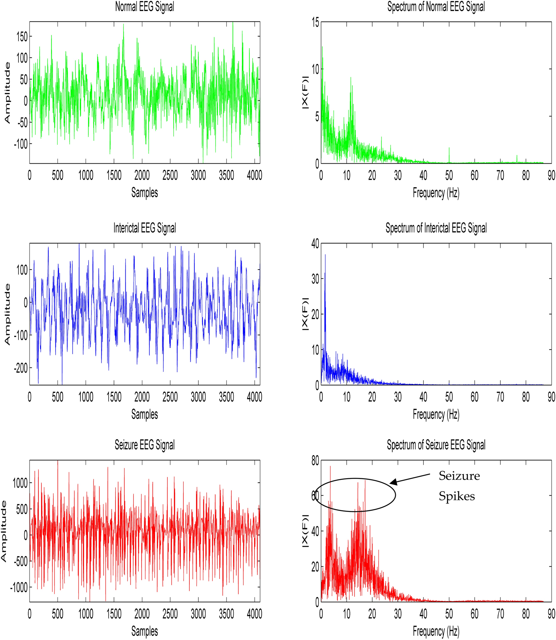 EEG-based epileptic seizure detection using binary dragonfly algorithm and  deep neural network | Scientific Reports