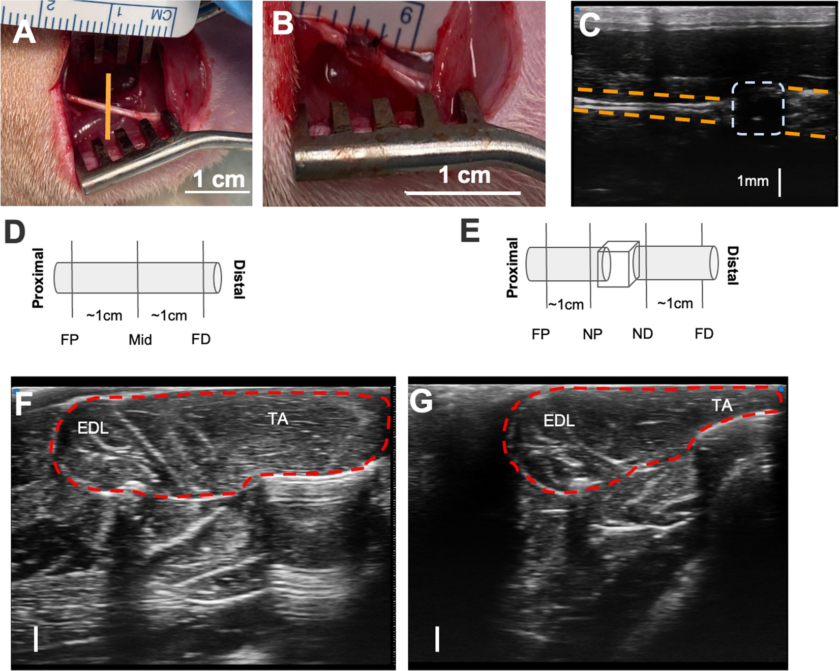bpc 157 nerve regeneration sciatic nerve rat Quantitative evaluation of rat sciatic nerve degeneration using  high-frequency ultrasound