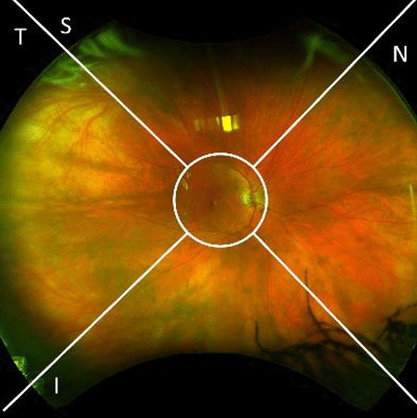 Overcoming Retinal Diseases: Can the Retina Heal Itself