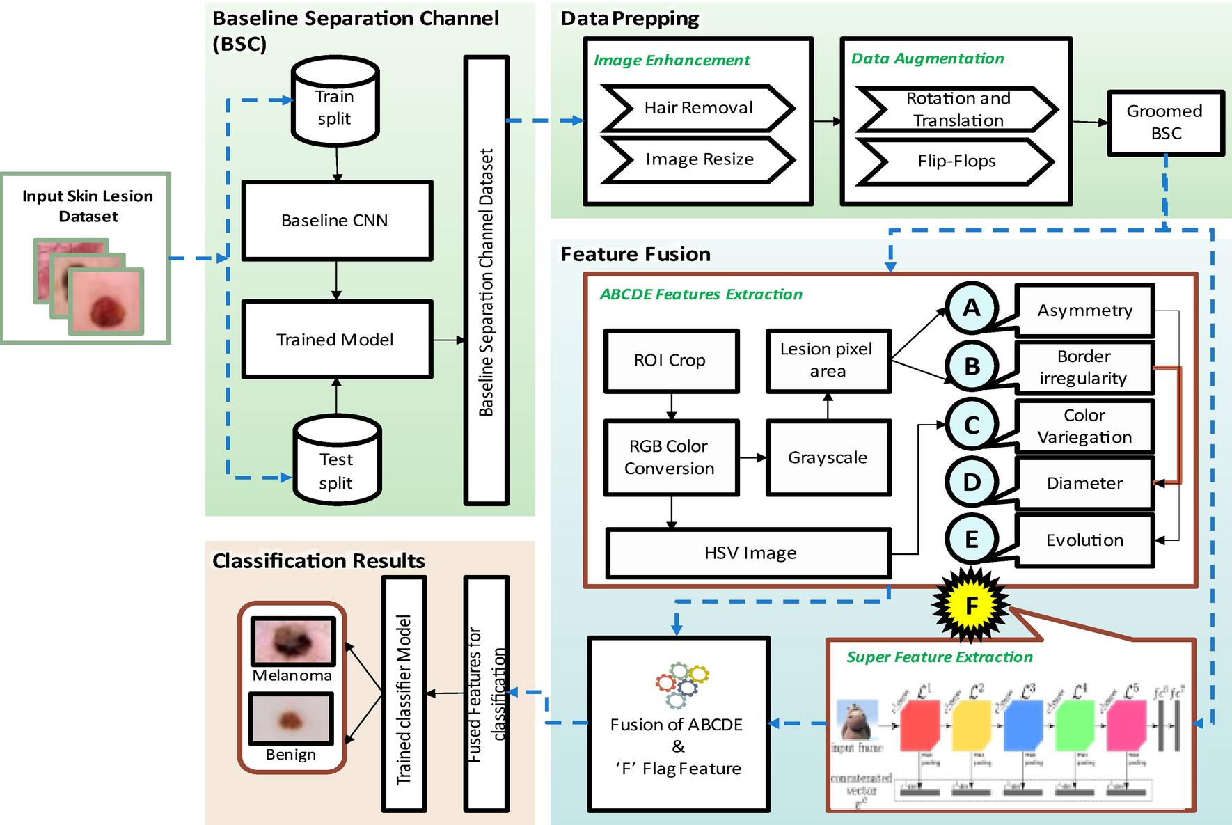 DDCNN-F: double decker convolutional neural network 'F' feature fusion as a  medical image classification framework