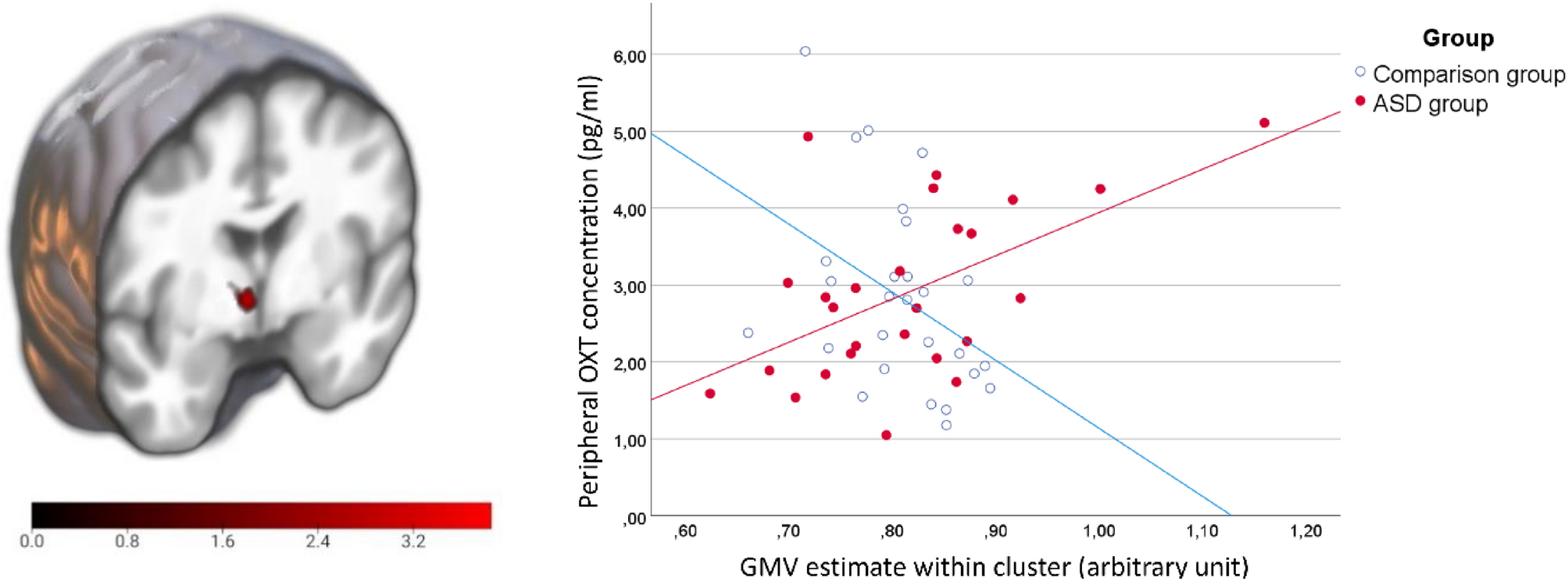 Peripheral oxytocin levels are linked to hypothalamic gray matter volume in  autistic adults: a cross-sectional secondary data analysis | Scientific  Reports