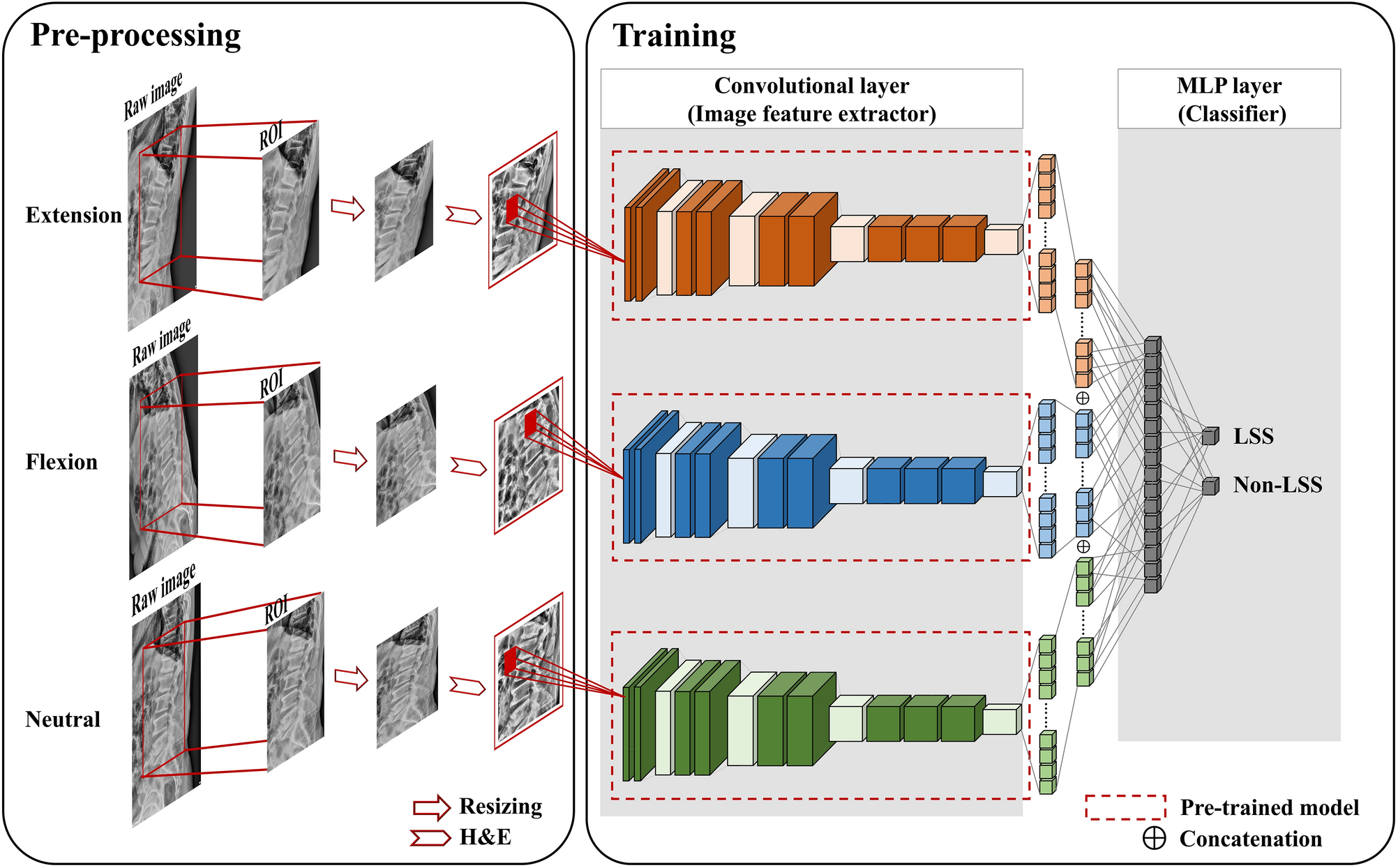 Multi-pose-based convolutional neural network model for diagnosis of  patients with central lumbar spinal stenosis | Scientific Reports