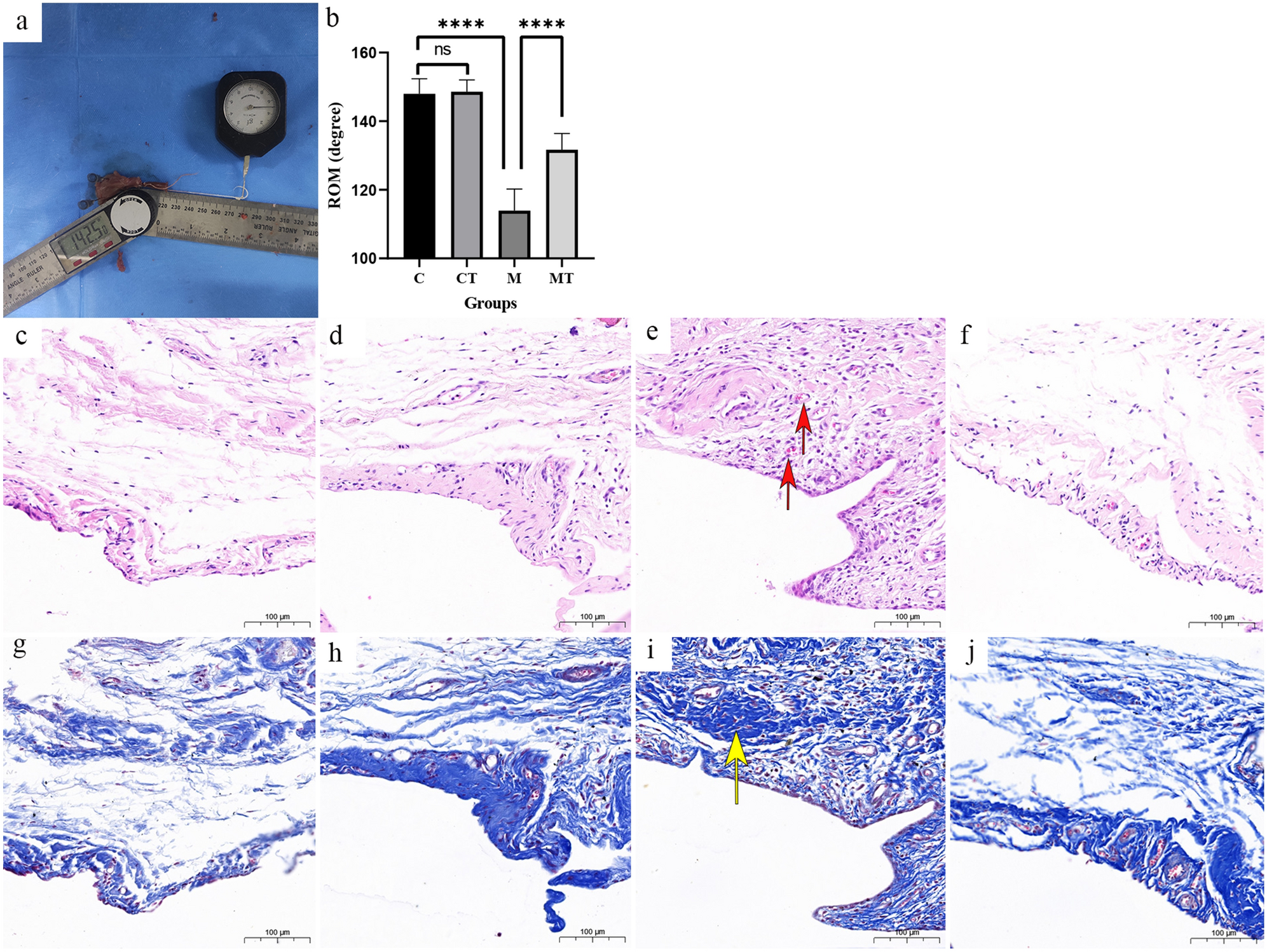 Proteomics and phosphoproteomics to study Tuina reverses capsule fibrosis  in frozen shoulder: a research report based on rats | Scientific Reports