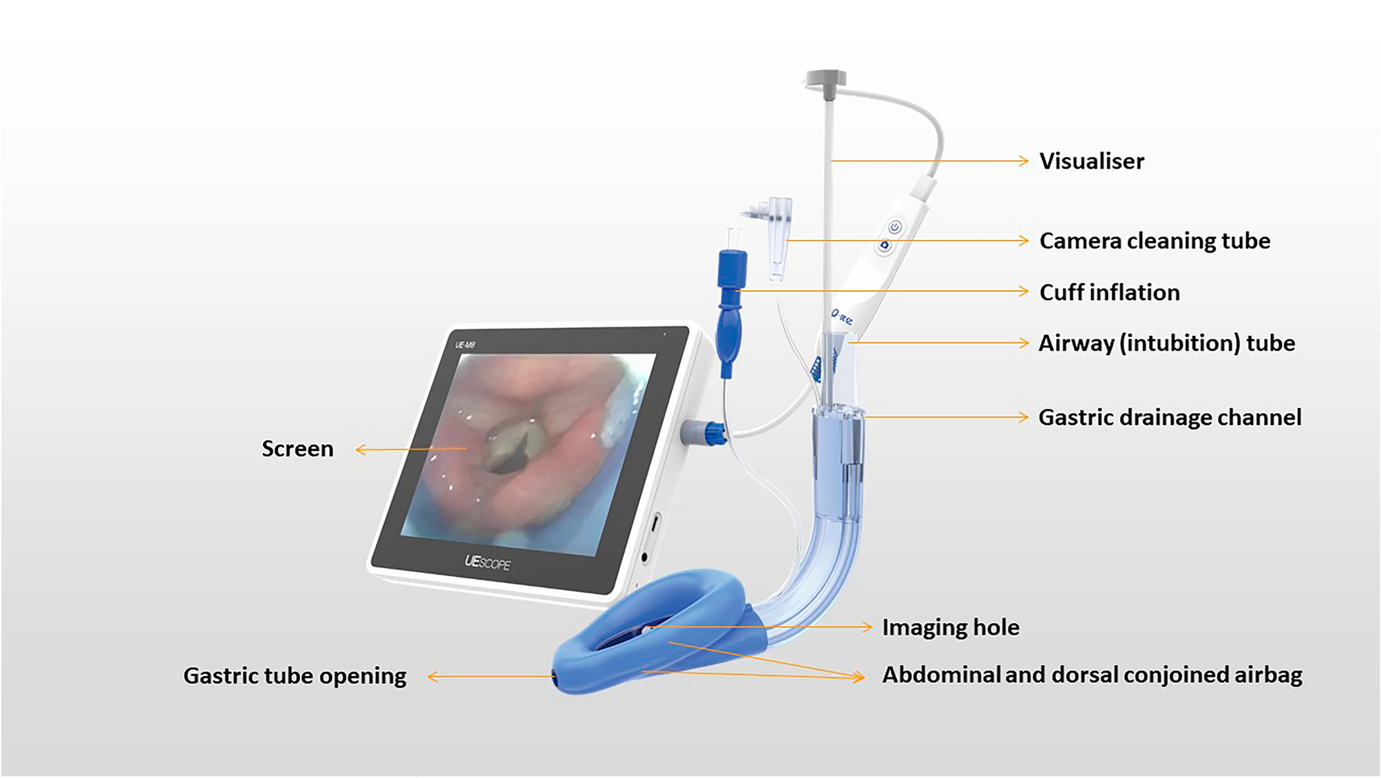 Placement of LMA (Laryngeal Mask Airway) - Trial Exhibits Inc.