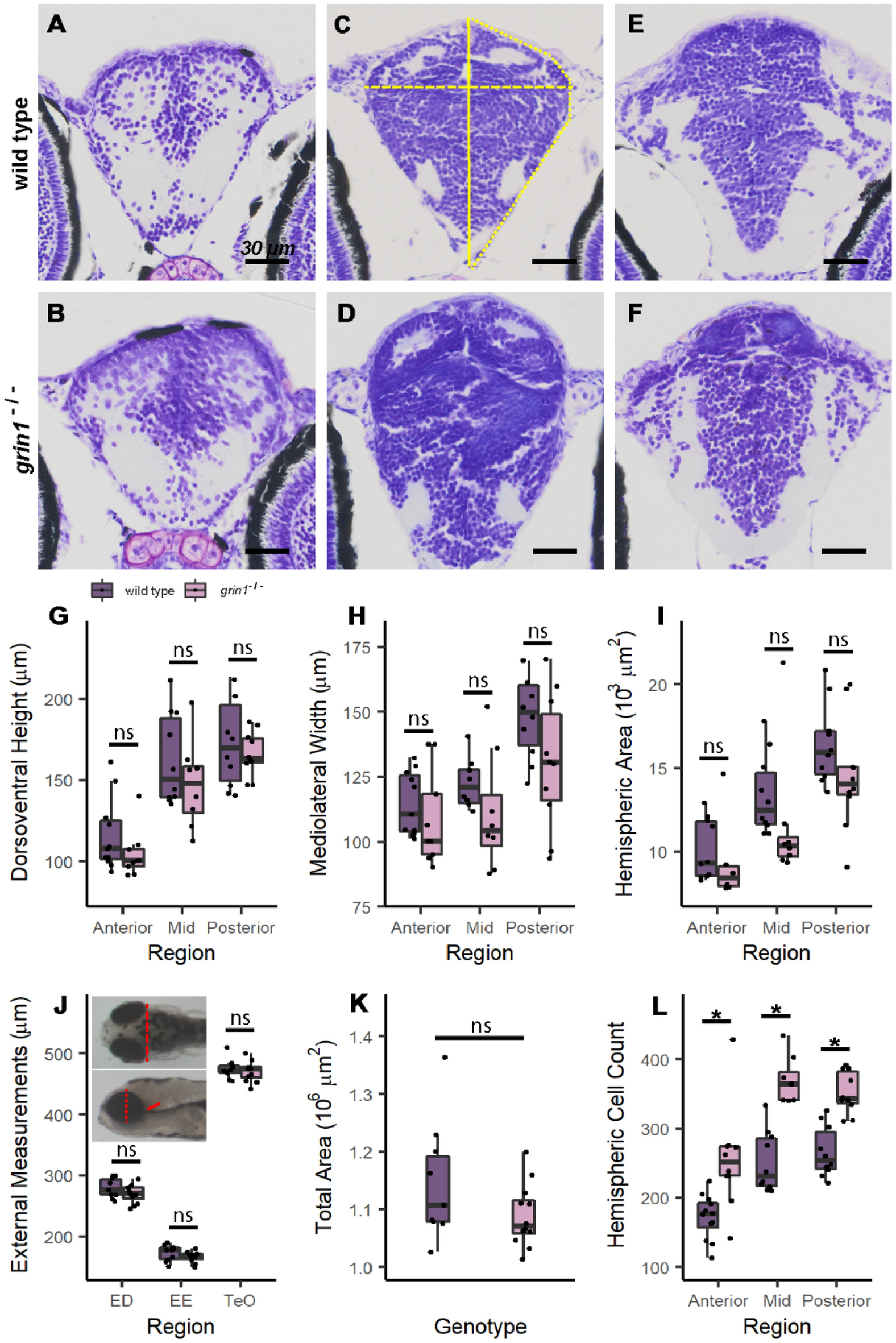Developmental loss of NMDA receptors results in supernumerary 