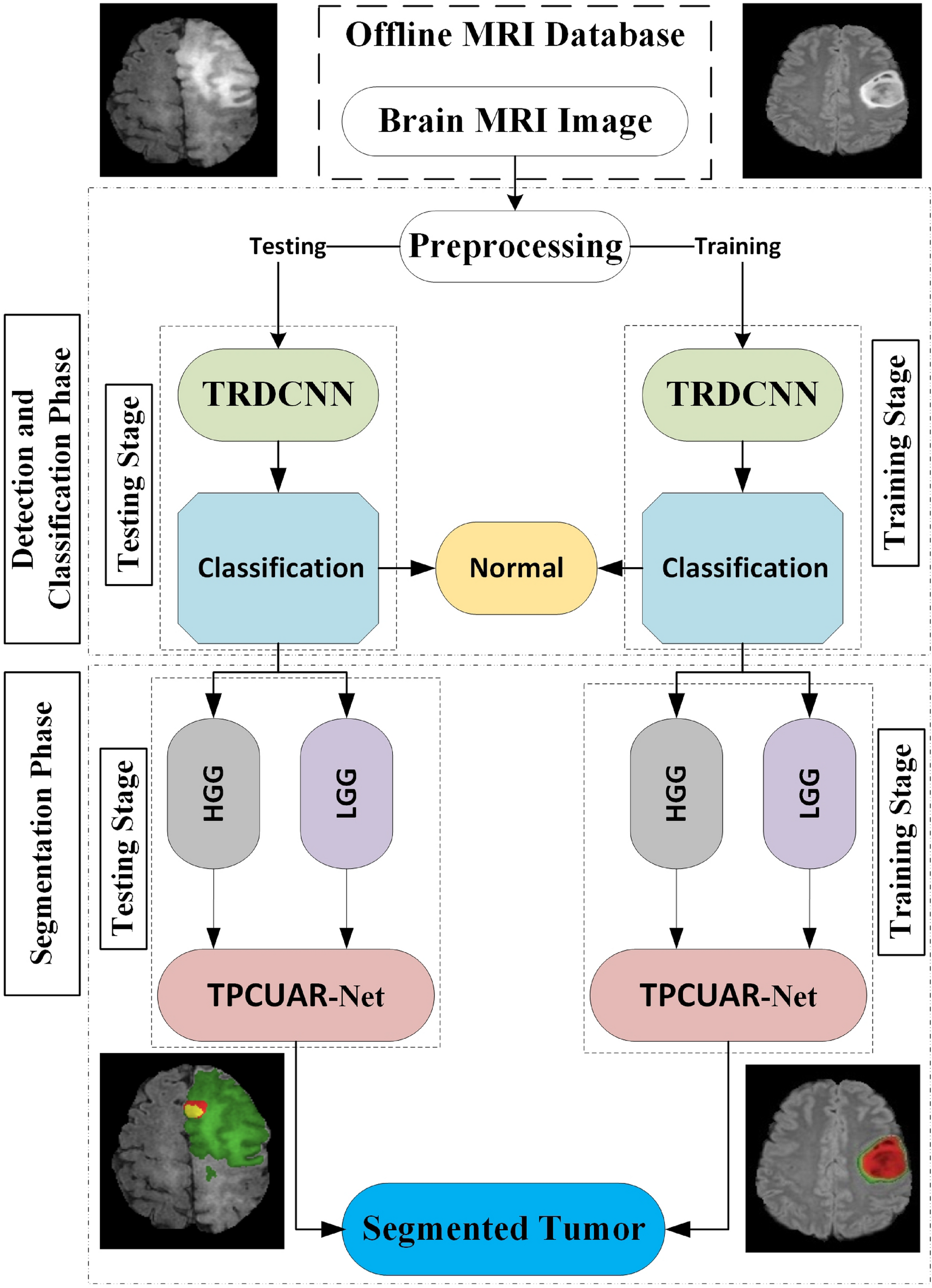 Automatic brain-tumor diagnosis using cascaded deep convolutional 