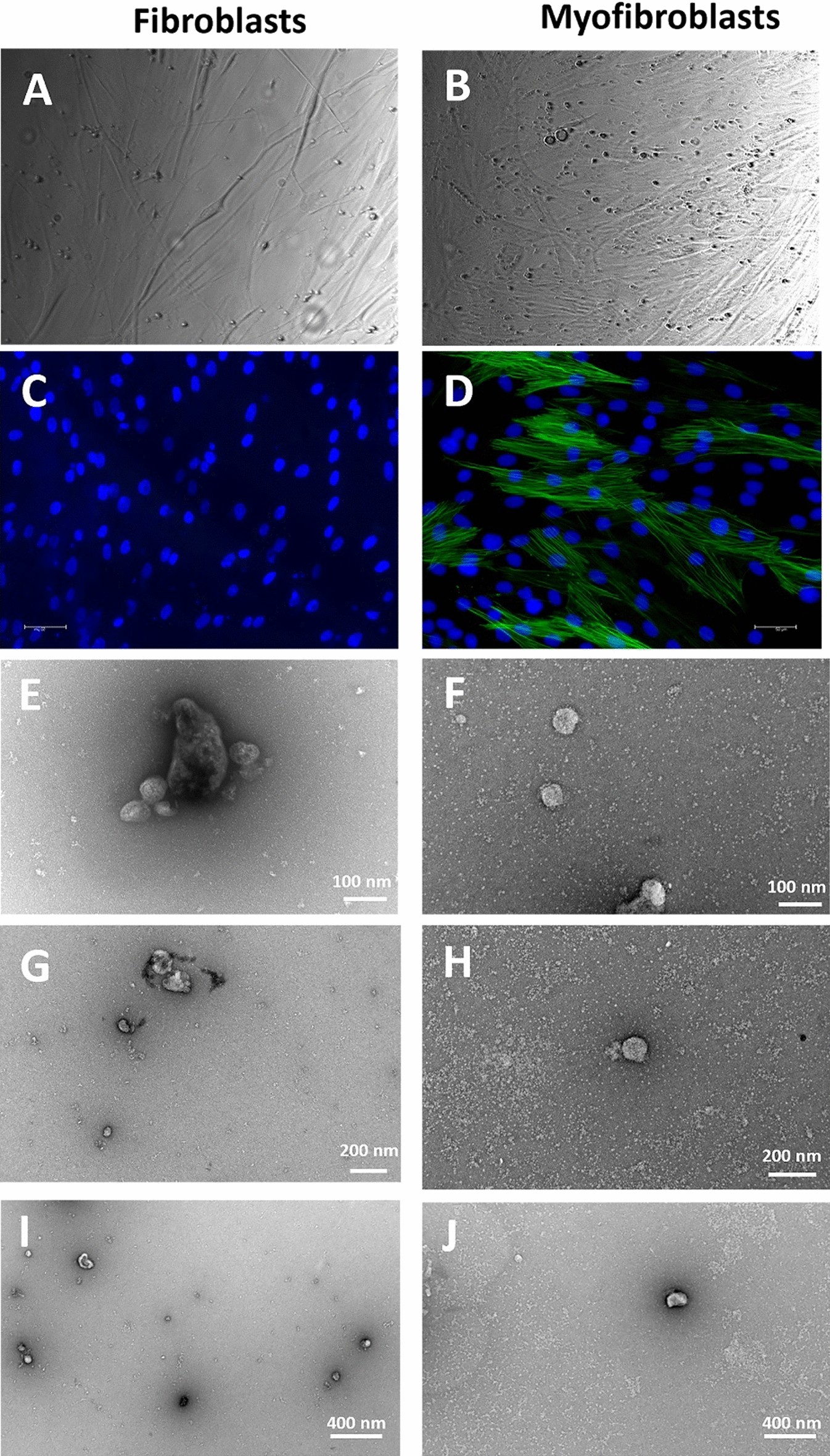 TGF-β1 induces formation of TSG-6-enriched extracellular vesicles in  fibroblasts which can prevent myofibroblast transformation by modulating  Erk1/2 phosphorylation | Scientific Reports