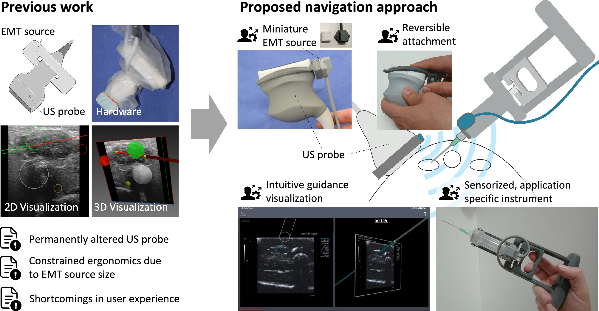 Miniaturized electromagnetic tracking enables efficient  ultrasound-navigated needle insertions | Scientific Reports