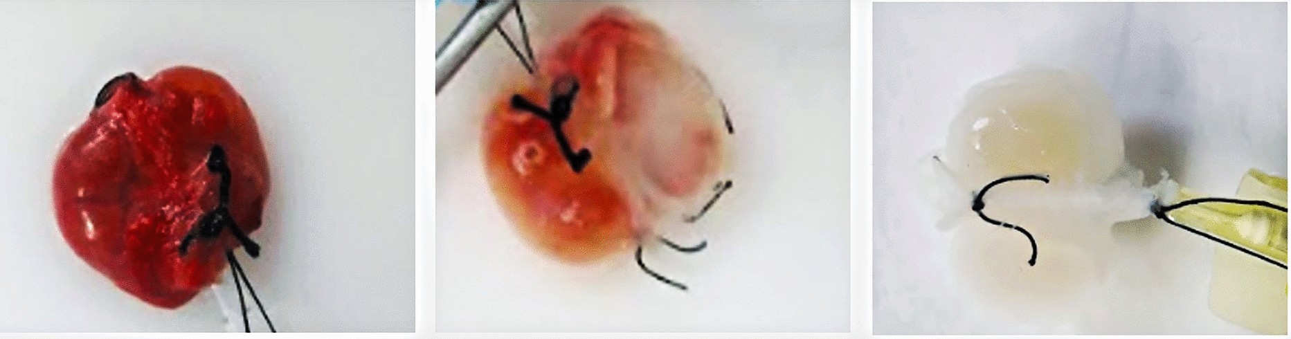 dihexa safety kidney AngIV-Analog Rescues Cognitive Impairment and Recovers Memory in the APP/PS1 Mouse via the PI3K/AKT Signaling Pathway Efficient decellularization of human fetal