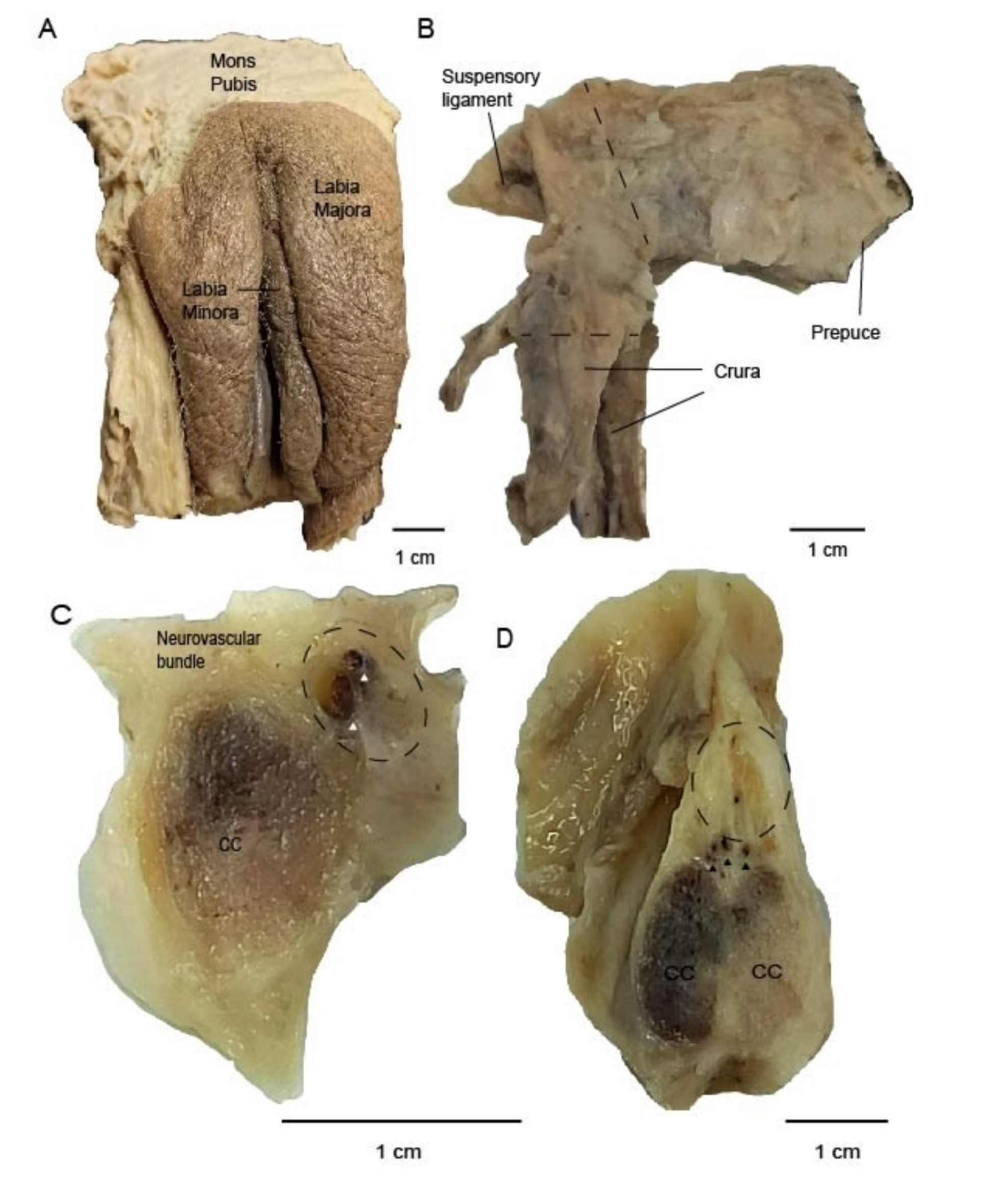 child examination clitoris Fetal Transient Clitoromegaly and Transient Hypertrophy of the Labia Minora  in Early and Mid Pregnancy - Zimmer - 2012 - Journal of Ultrasound in  Medicine - Wiley Online Library