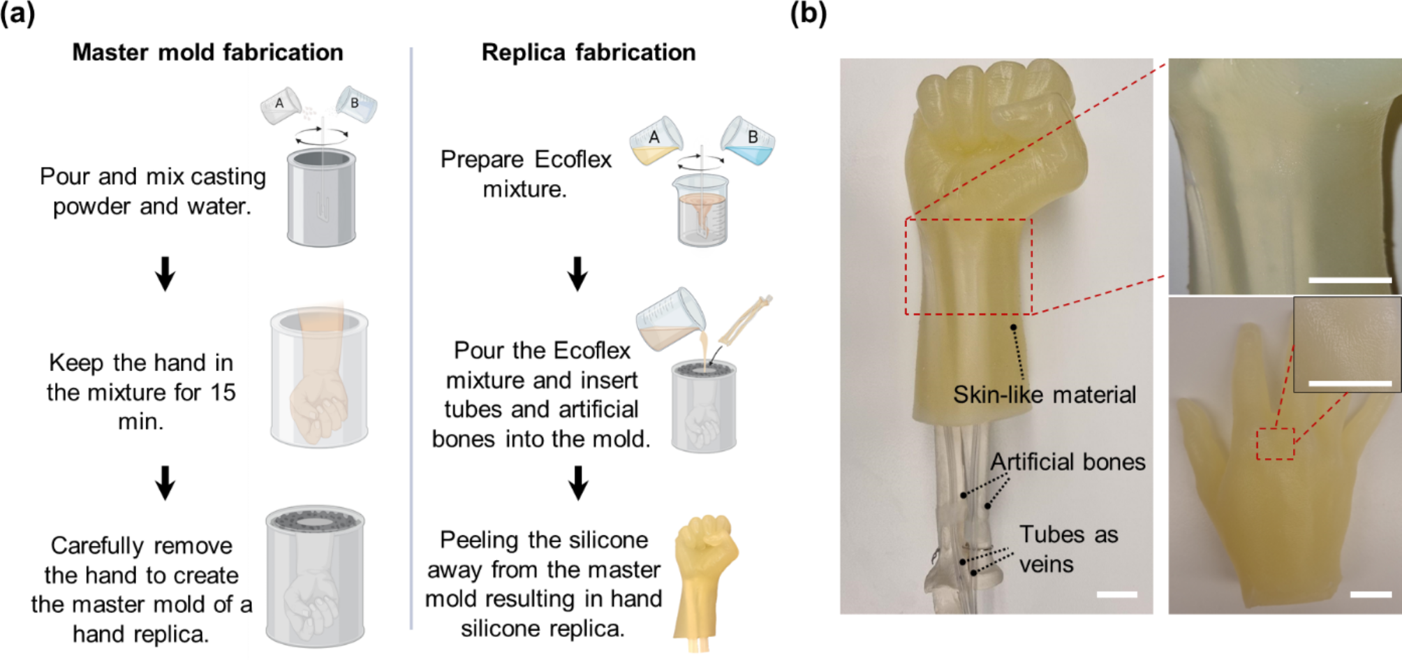 プロテーゼ材料が静脈内カテーテルからの感染を減少させる可能性(Prosthetic Material Could Help Reduce Infections From Intravenous Catheters)